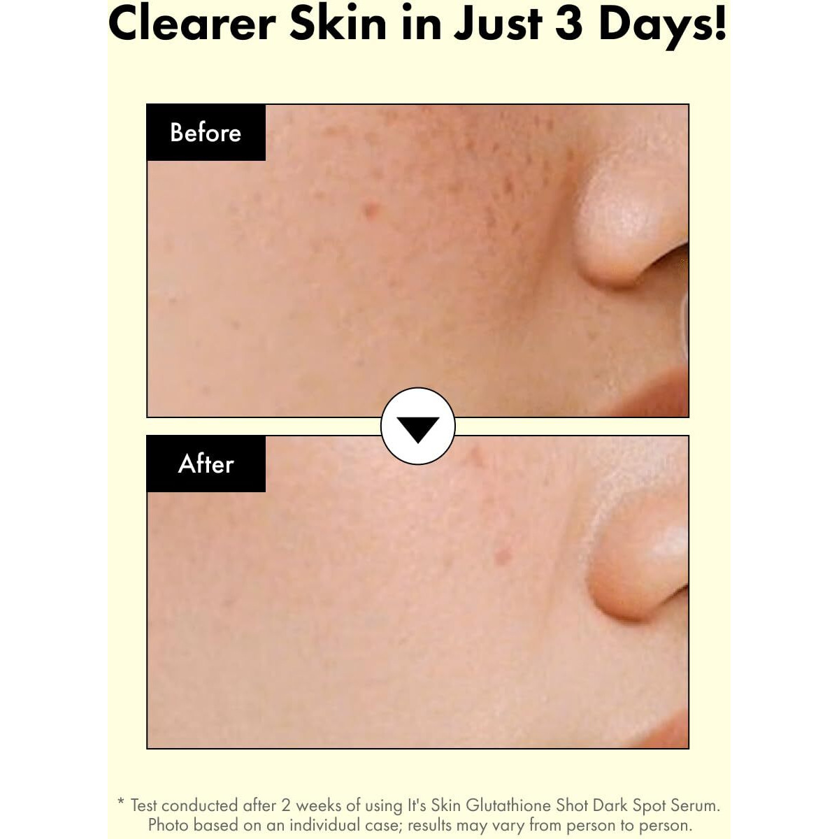 It's Skin Glutathione Shot B3 Serum 1.01 Fl Oz, Niacinamide Facial Serum, Dark Spot Corrector, Face Exfoliation, Hydrating Serum For Hyperpigmentation, Acne Scars, Blemish Spot, Korean Skincare