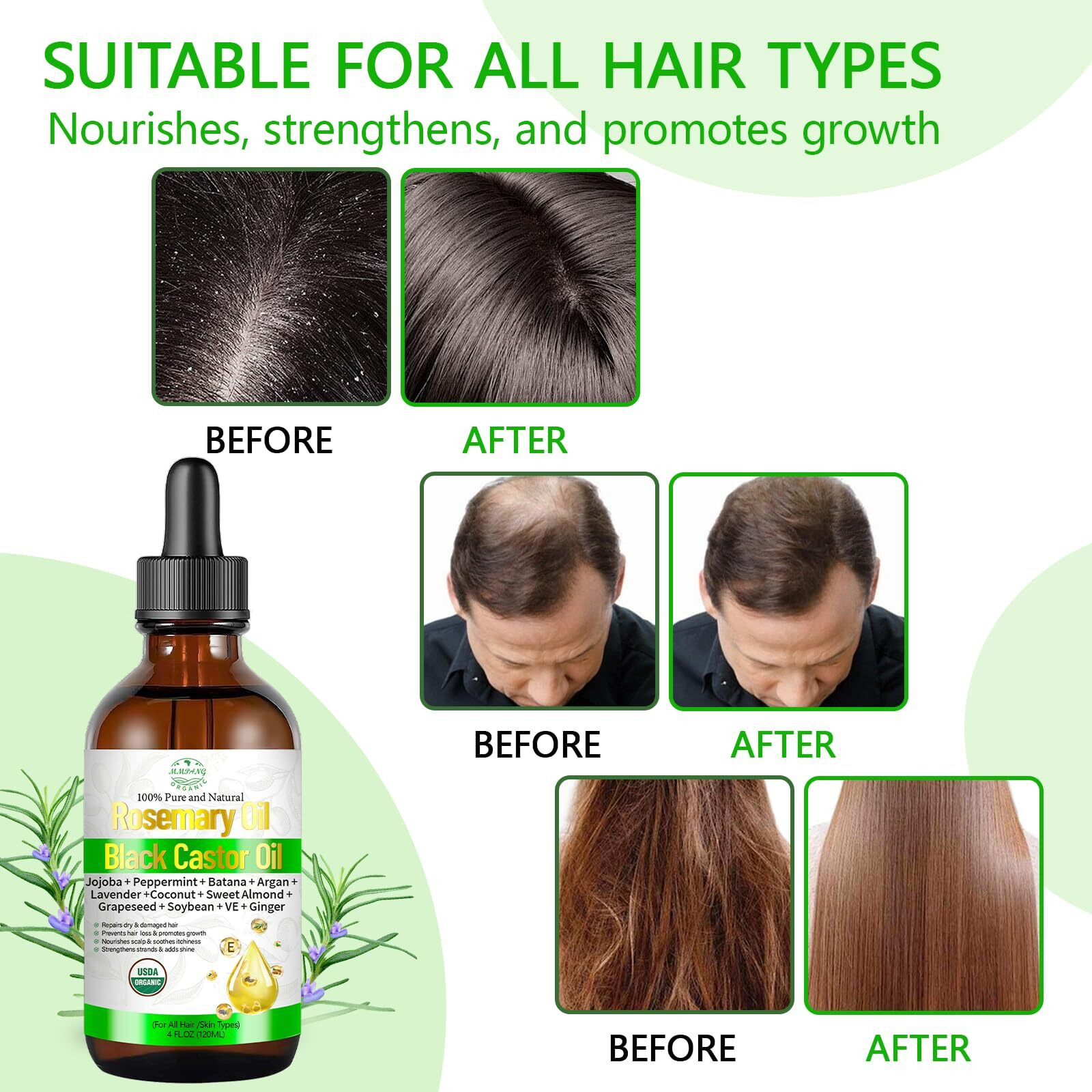 Rosemary Oil For Hair Growth With Castor, Organic Cold Pressed Blend Hair Oil Natural Scalp Care - Soothes Itchy Scalp, Repairs Dry Hair & Nourishes Roots For All Hair Types - 4 Fl Oz