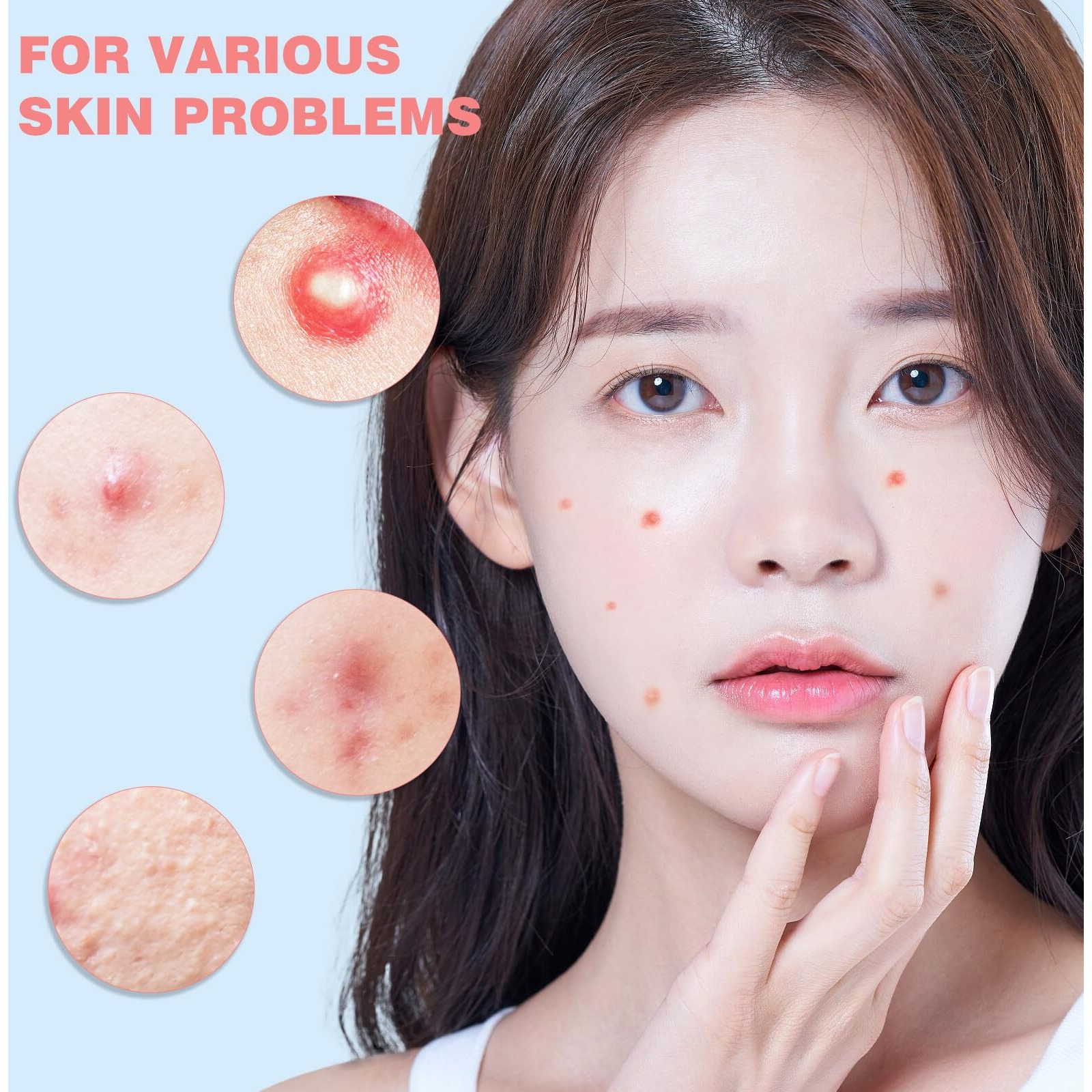 Hloes Pimple Patches For Face 360Pcs, Hydrocolloid Acne Patches For Covering Zits And Blemishes, Cute Star Pimple Patches, Facial Skin Care Products.