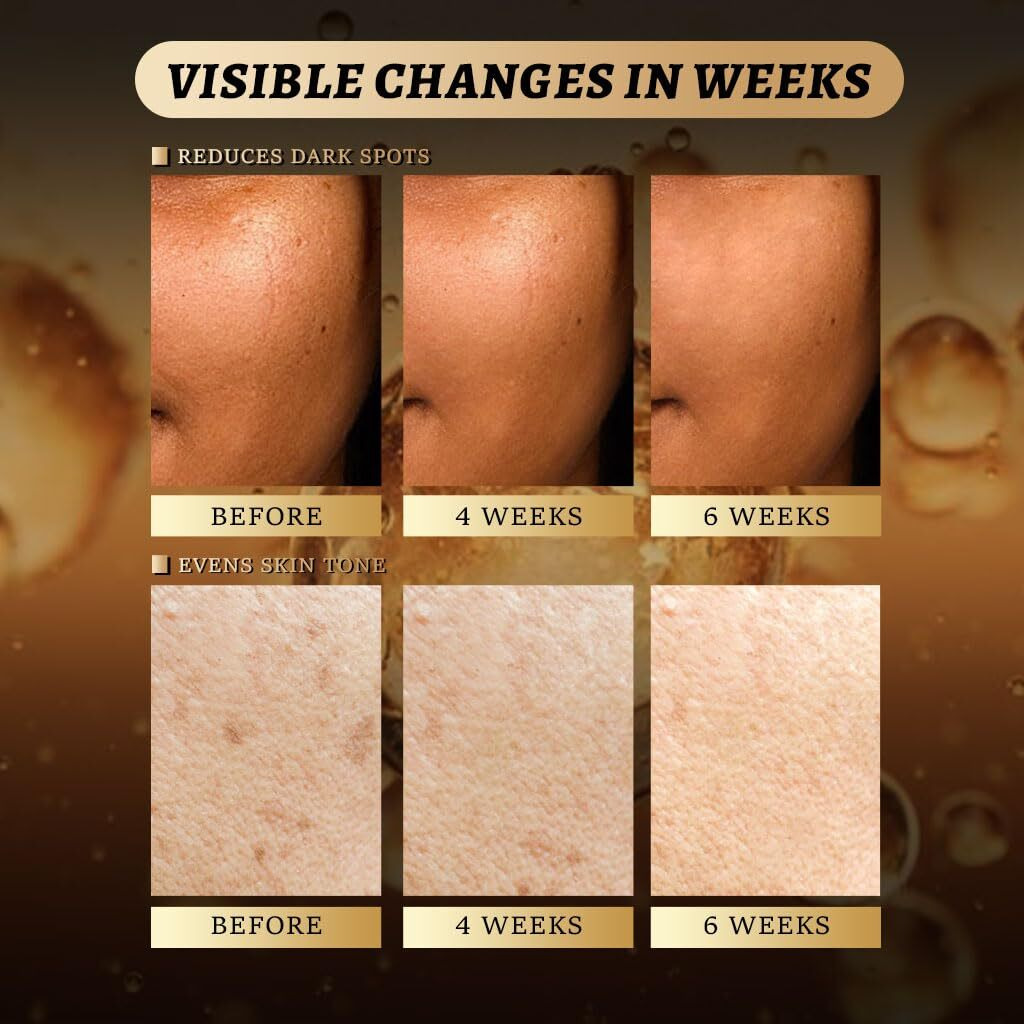 Turmeric Kojic Acid Cleansing Pads - Travel-Size Individually Packaged Face Scrub Pads (60Pcs) - Gentle Exfoliating & Brightening For Dark Spots & Hyperpigmentation - With Glycerin And Citric Acid