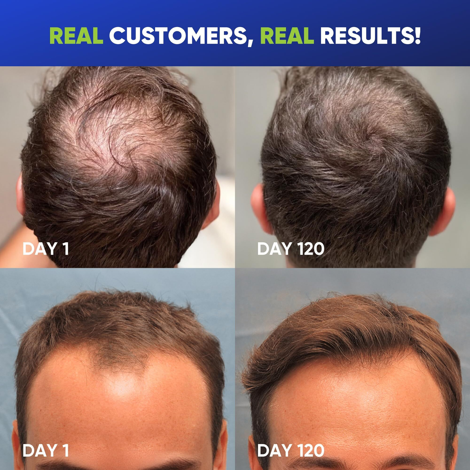 Svvimer Hair Growth Shampoo For Men - Biotin Thickening Shampoo With Rosemary Tea Tree Oil Caffeine For Hair Loss And Thinning - 13.5 Fl Oz (Pack Of 1)