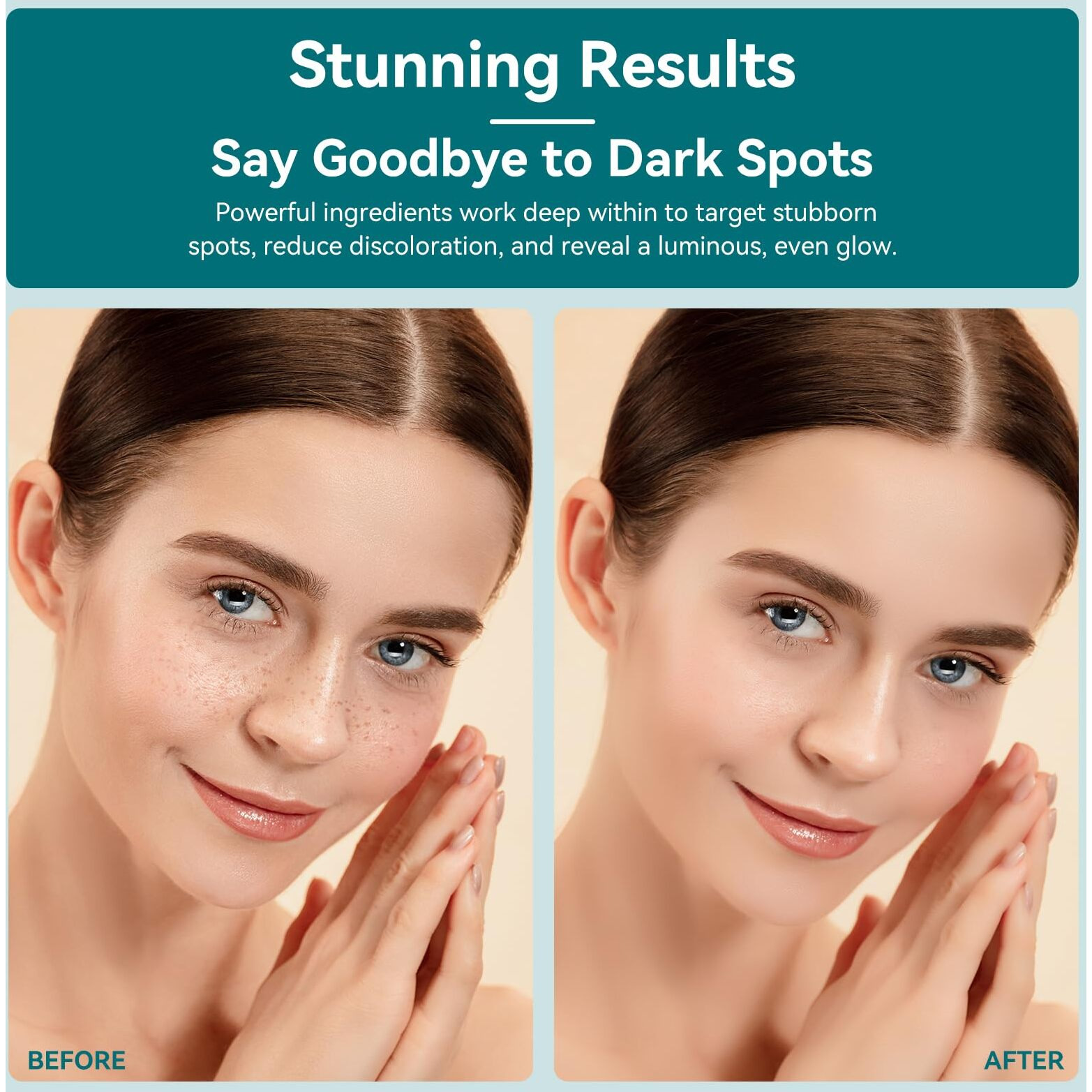 Dark Spot Remover For Face With 360 Roller Massage Ball, Dark Spot Corrector Serum For Face, Fade Sun Spot Age Spot Brown Spot For All Skin Types, 0.67 Fl. Oz