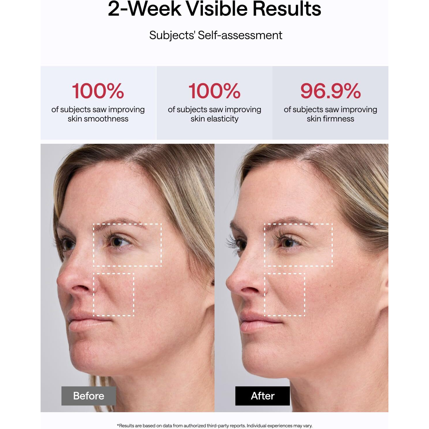 Jmoon Nouvelleskin Facial Toning Device, Fda-Cleared Microcurrent Facial Device And Red Light Therapy For Face, 4 Modes & 5 Intensity Levels For Personalized Face Lift & Smoothing. M30U Pr