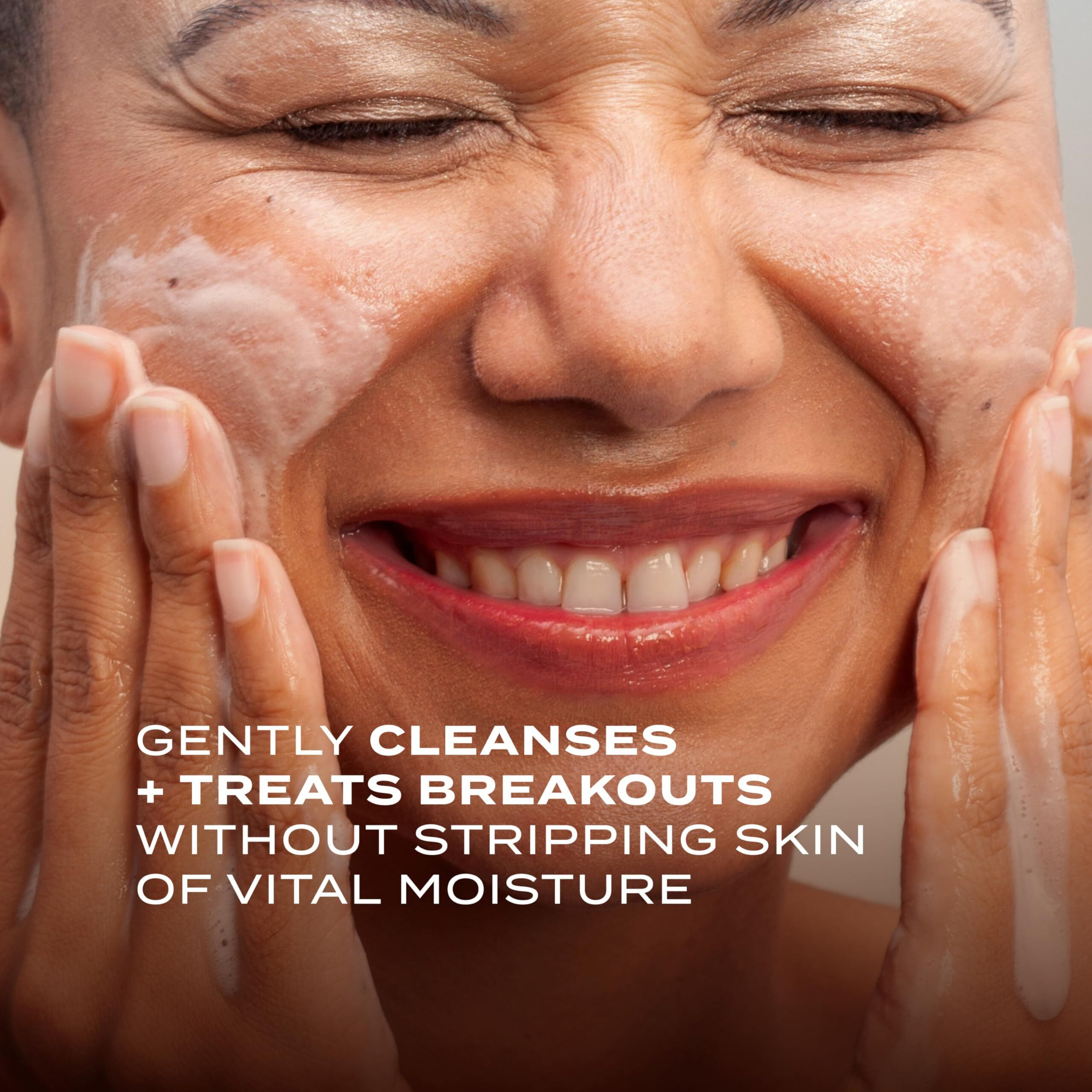 Murad Clarifying Cream Cleanser - Anti-Aging Time Release Acne Face Cleanser | Encapsulated Salicylic Acid For Blemish-Prone Skin (5 Oz)