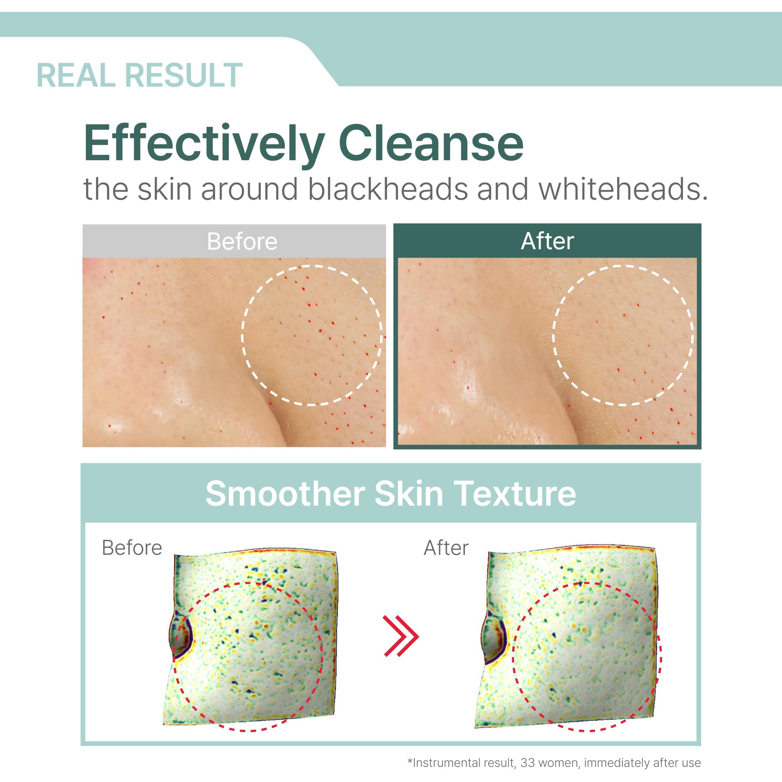 Illiyoon Gentle Deep Cleansing Oil | Lightweight Facial Cleanser With Coconut Oil & Aha/Bha For Makeup, Fragrance-Free, Sebum & Blackhead Removal, Korean Skin Care, 8.45 Fl.Oz.