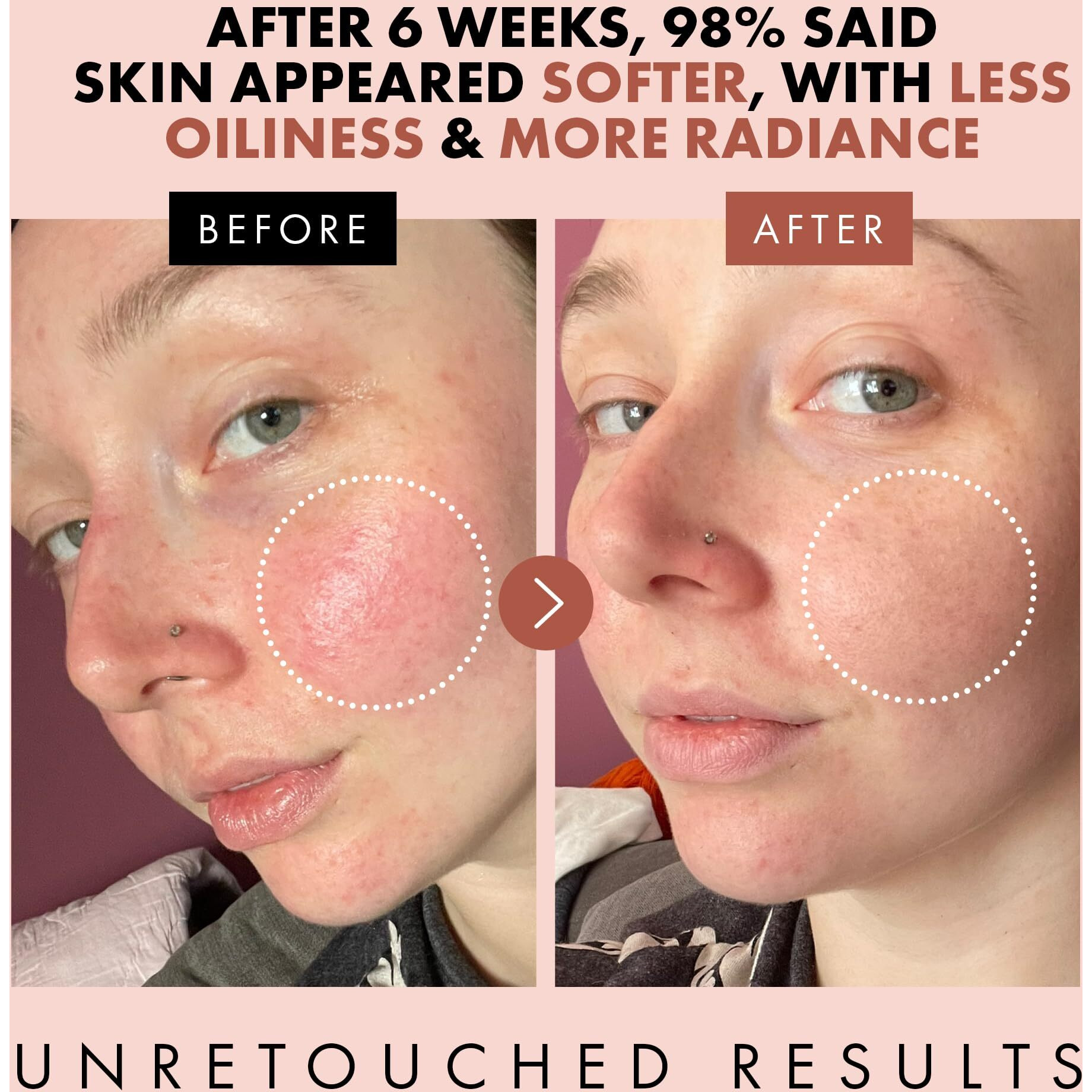 Eclat Skincare Rose Water Toner - Hydrating Toner For Face - Rosewater With Hyaluronic Acid & Aloe Vera - Alcohol Free & Skin Soothing Formula - Rejuvenating & Calming Facial Skin Care