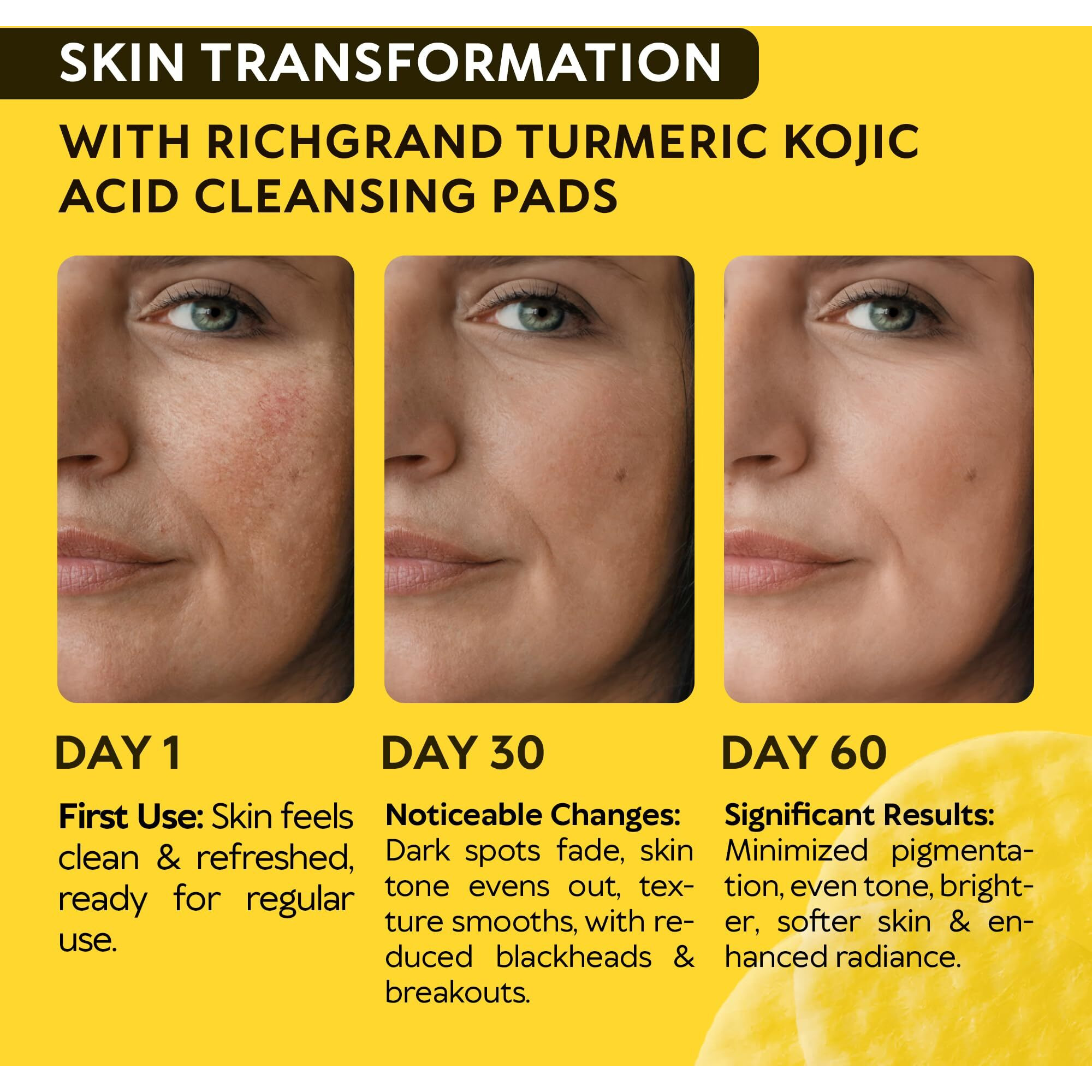 Turmeric Kojic Acid Cleansing Pads - Exfoliating Turmeric Pads For Face Dark Spots, Discoloration And Sensitive Skin Care - Natural Radiance Facial Wash