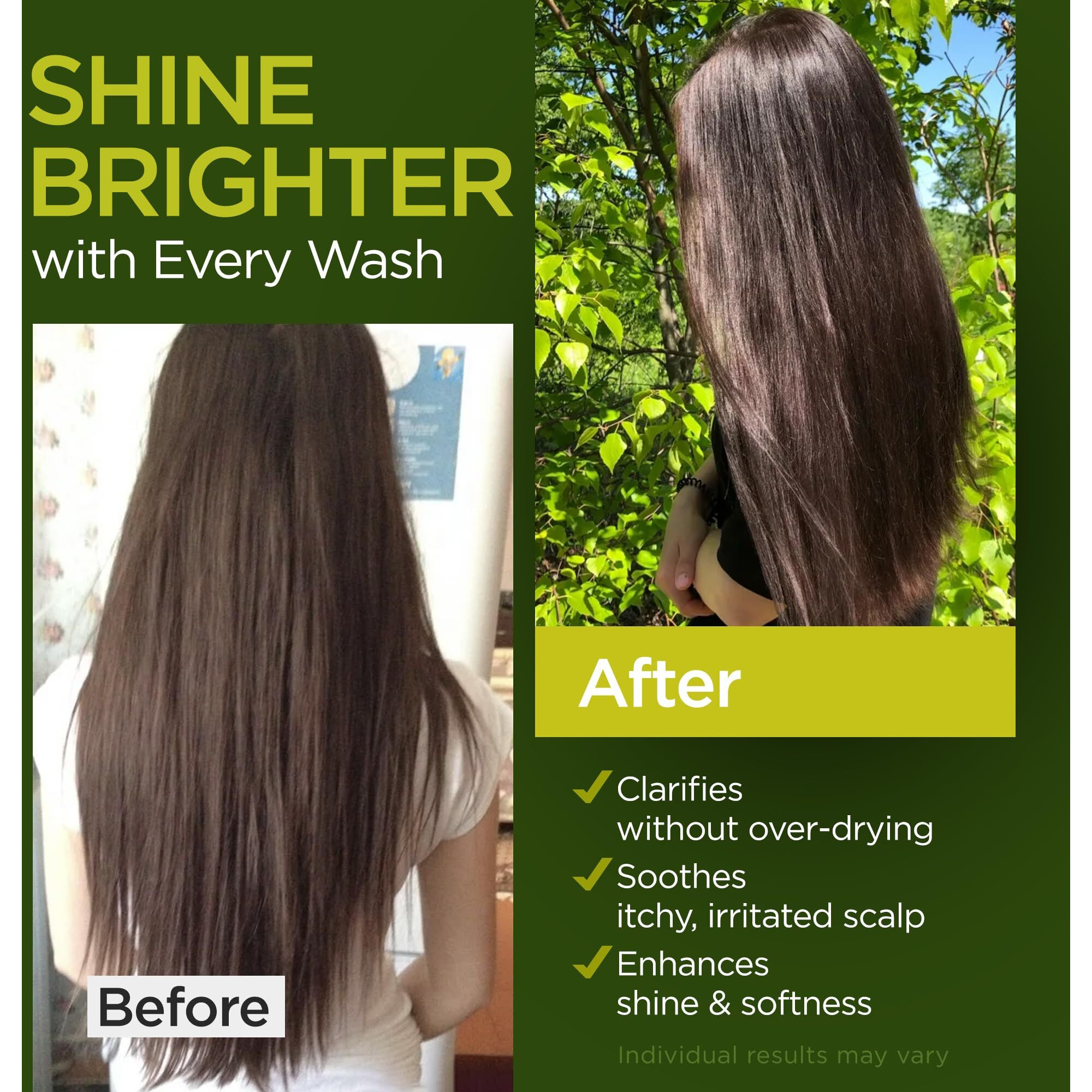 Tea Tree Rosemary Shampoo And Conditioner Set With Castor Oil For All Hair Types - Effective Cleanse And Supports Scalp Health For Women & Men Paraben & Sulfate Free (16 Oz Each)