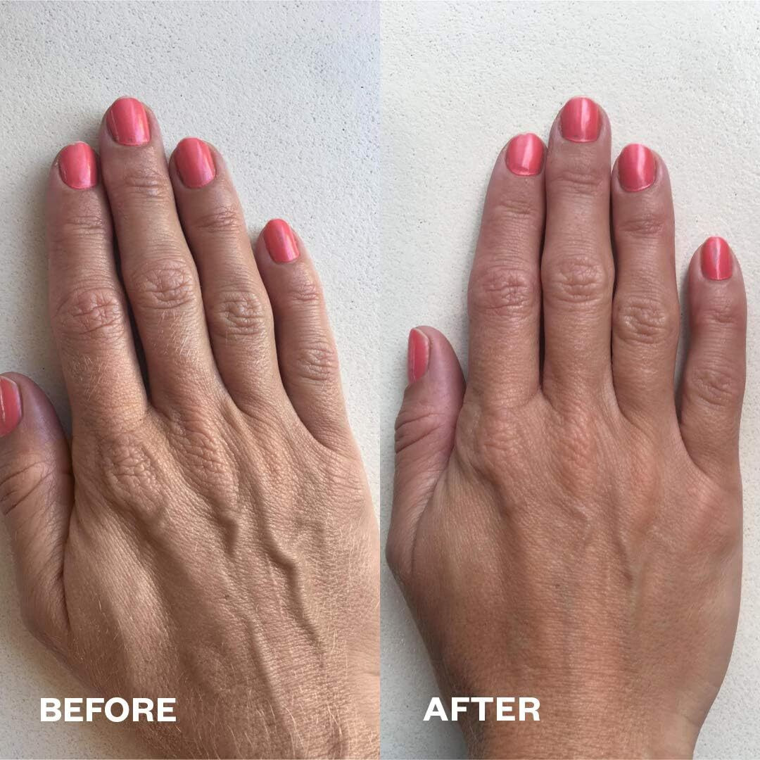 Wrinkles Schminkles Hand Wrinkle Patches - Reusable Silicone Wrinkle Pads For Dehydrated, Weathered & Sun-Exposed Hands, Reduce Hand Wrinkles - Ideal For Overnight Use (2 Pack)