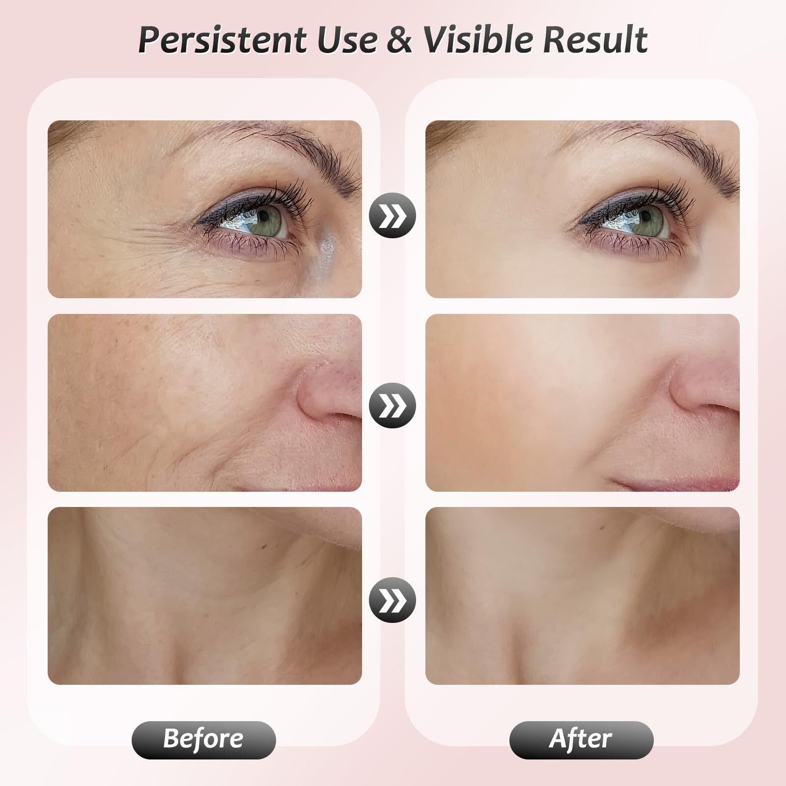 Face Massager Tool, Facial Massager 7 Color, Facial And Neck Massager, Multifunctional Facial Skin Care Tool, Face Neck Massager For Daily Skin Care Routine, White