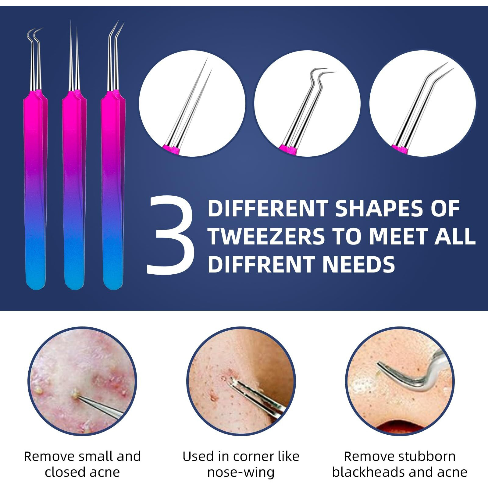 Pimple Popper Tool Kit - Ybaoo 10 Pcs Blackhead Remover Comedone Extractor Kit With Metal Case For Quick And Easy Removal Of Blackheads, Zit Removing, Facial And Nose(Colorful)
