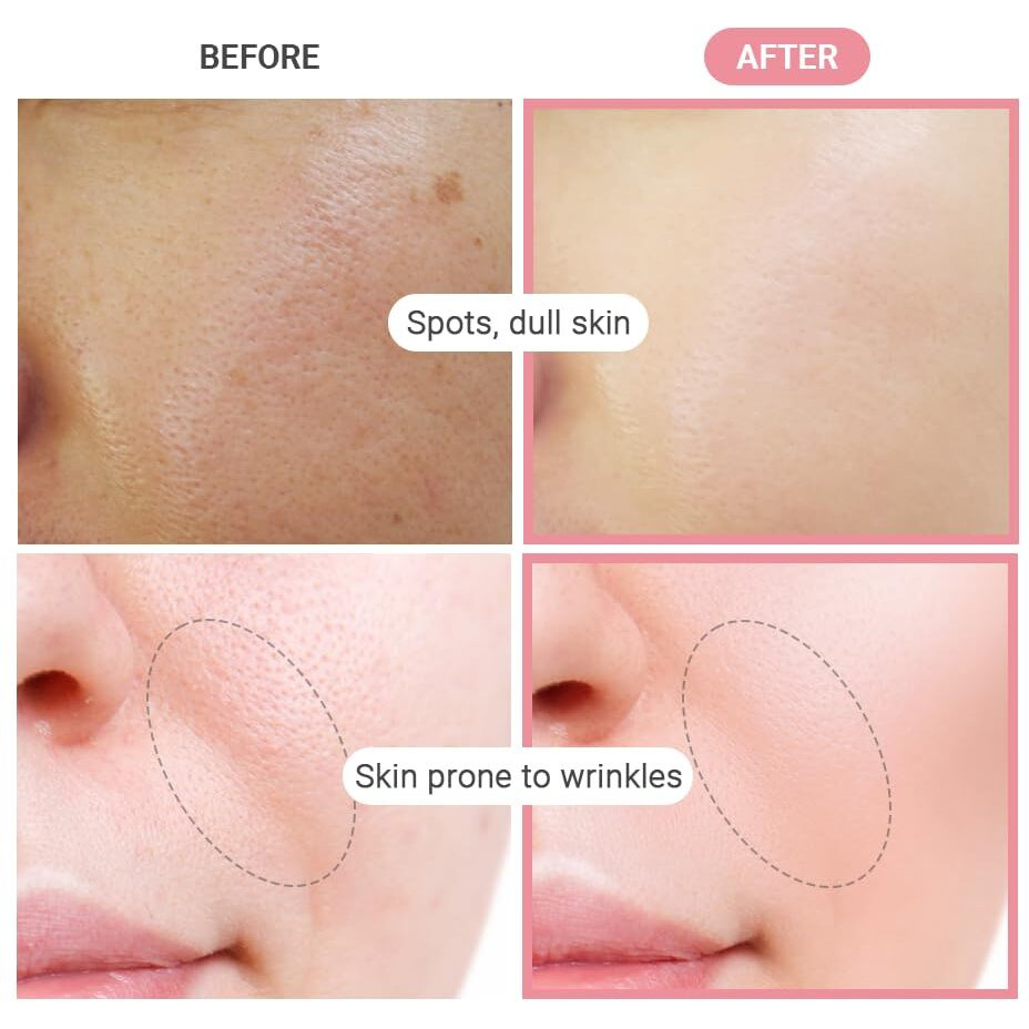 Tenzero Pink Hyaluronic Acid Niacinamide Serum Heart Pad 50Ea, Hydrating & Brightening Glowing Face Toner Pads, Korean Facial Radiance Pads, Dry Skin, 150G