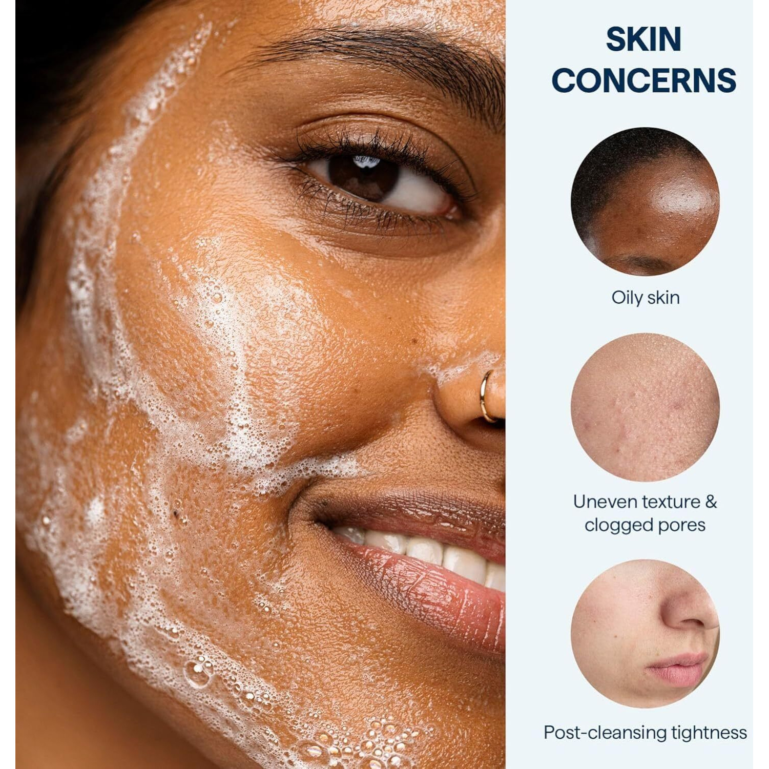 Remedy For Lightweight Cleansing - Gel To Foam Cleanser For Normal To Oily Skin - 0.5% Salicylic Acid, Ceramides, Glycerin, Green Tea - By Dermatologist Dr. Shah, 5 Fl. Oz