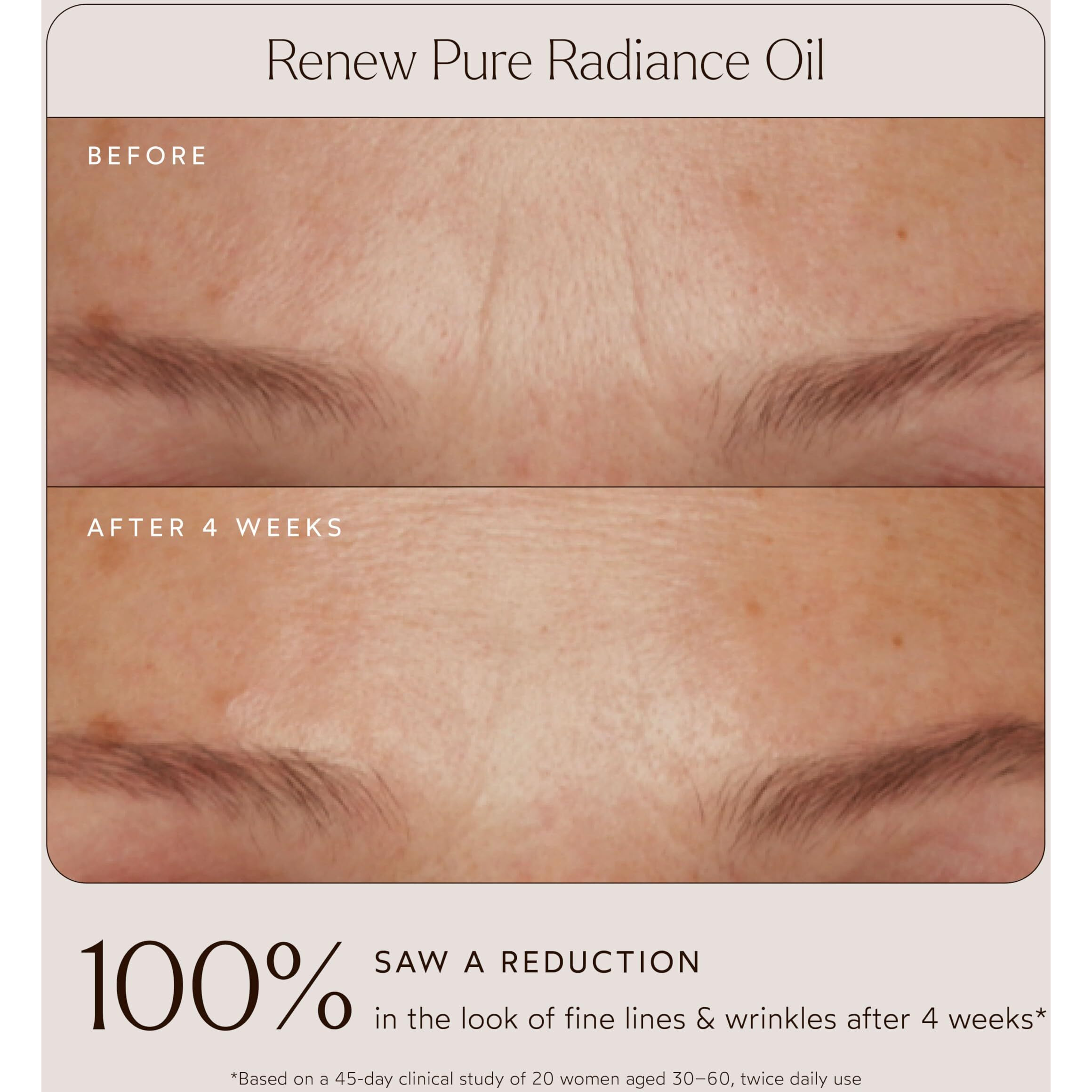 True Botanicals Tried & True Wellness Essentials Bundle | Ginger Turmeric Cleansing Balm | Chebula Active Serum | Pure Radiance Oil | Phyto-Retinol Advanced Clinical Cream | Glossy Lip Balm