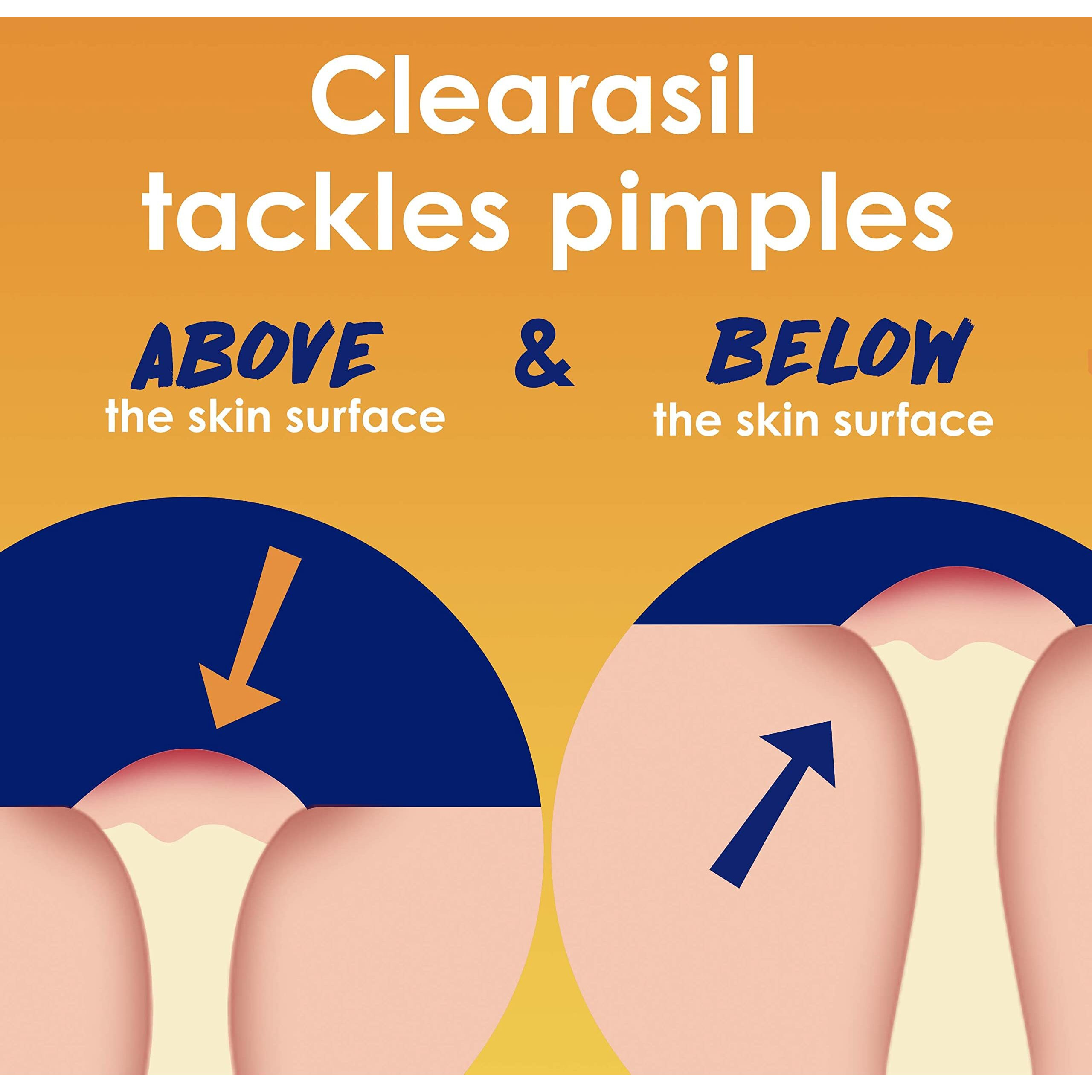 Clearasil Stubborn Acne Control 5in1 Exfoliating Wash, Maximum Strenght with 2% Salicylic Acid Acne Treatment Medicine, Daily Acne Facial Cleanser 6.78 fl oz