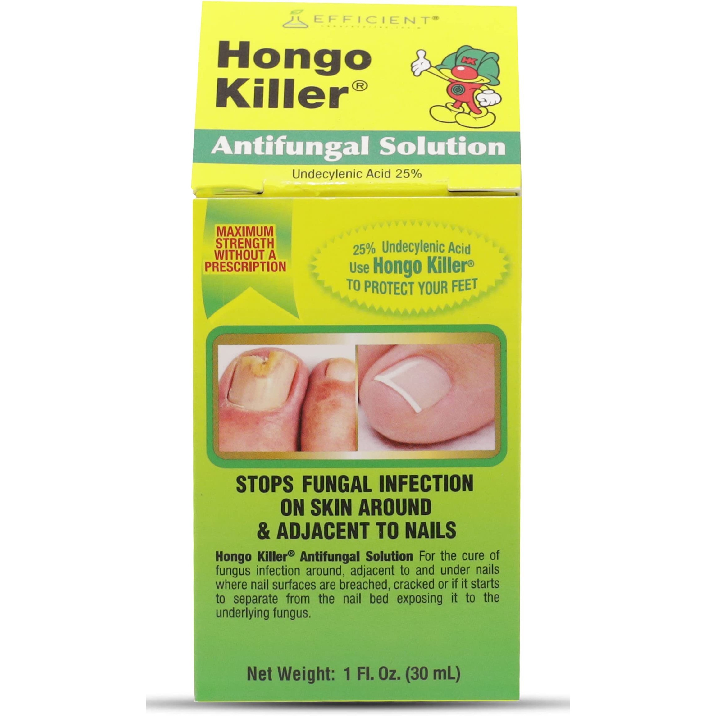 HONGO KILLER Antifungal Solution, Athlete's Foot Treatment, Multicolor, 1 Fl Oz