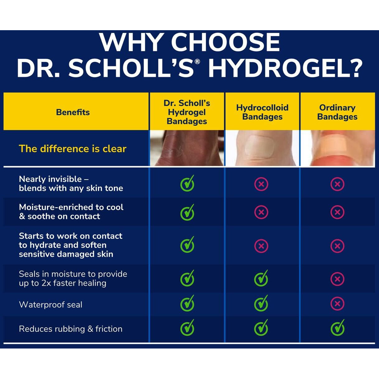 Dr. Scholl's BUNION CUSHION with Hydrogel Technology, 5ct // Cushioning Protection against Shoe Pressure and Friction that Fits Easily In Any Shoe for Immediate and All-Day Pain Relief