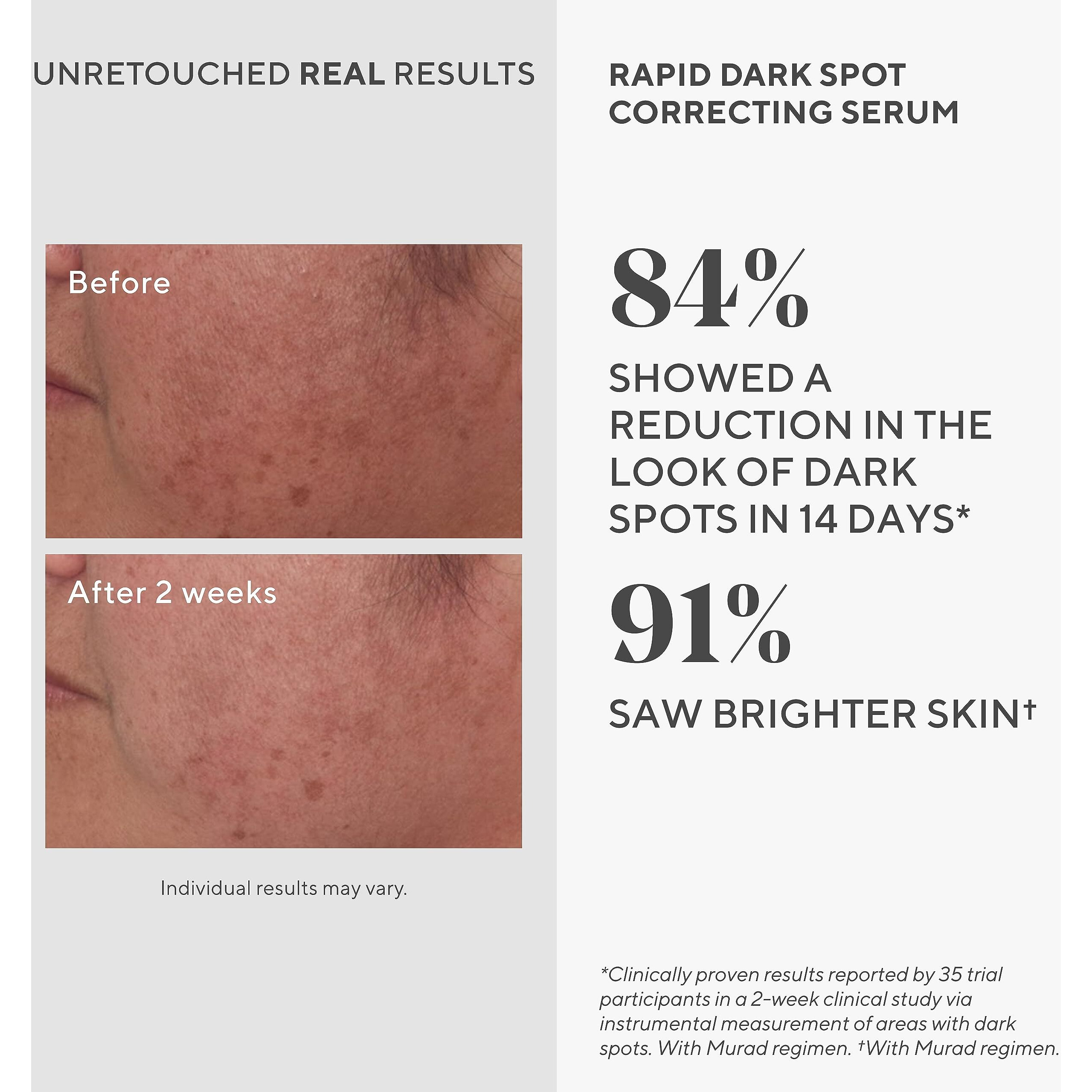 Murad Rapid Dark Spot Correcting Serum - Skin Brightening Face Serum For Hyperpigmentation - Glycolic Acid Treatment Backed By Science  Travel Size 0.33Fl Oz