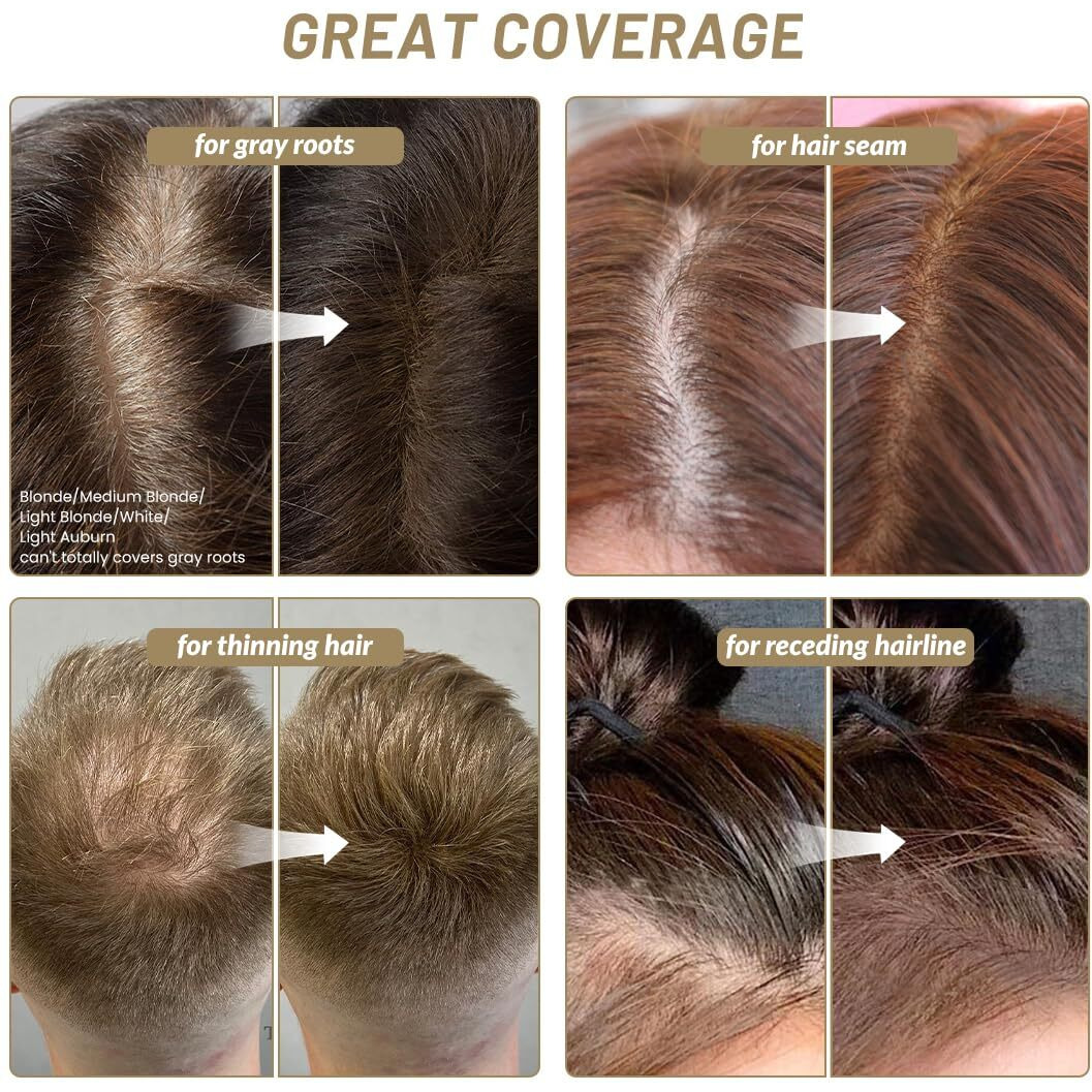 Instantly Hairline Powder Hairline Shadow Gray Hair Coverage Touch Up Hair Powder For Thinning Hair For Women White