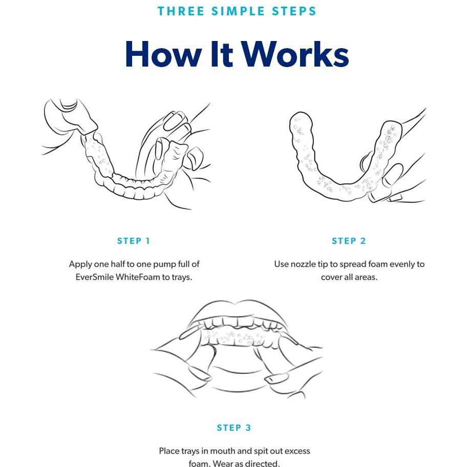 Eversmile Alignerfresh Extra Whitening Aligner & Retainer Cleaning Foam. Alignerfresh Cleaning Foam For Invisalign  Clearcorrect  Essix  Hawley Trays/Aligners. Cleans  Kills Bacteria & Whitens Teeth.