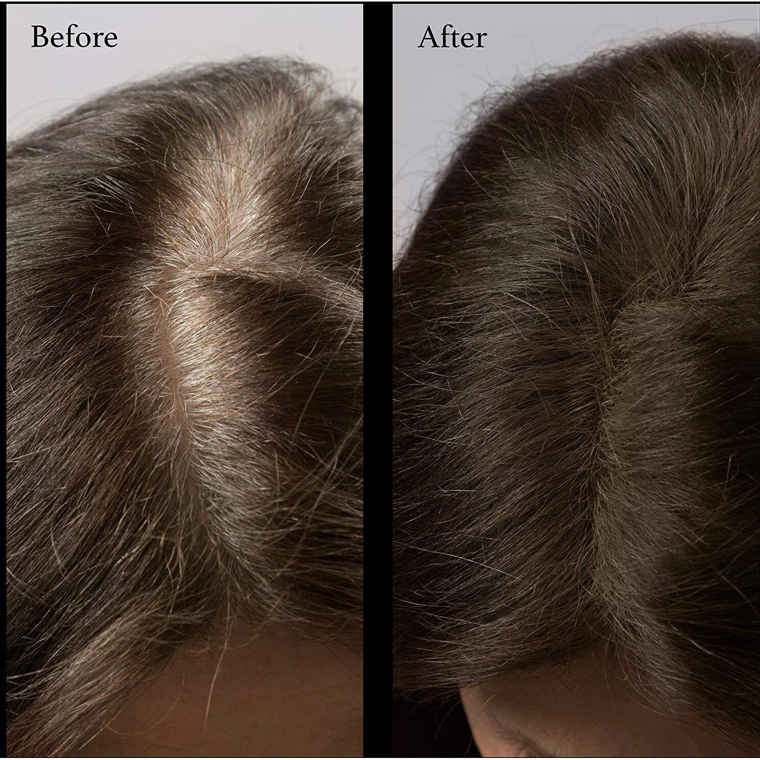 Nubeauti Hair Root Touch Up Powder - Darkest Brown - 11 True-To-Nature Root Concealer Shades - Longer-Lasting  Easy Hairline Shading With Clean Ingredients - With Brush