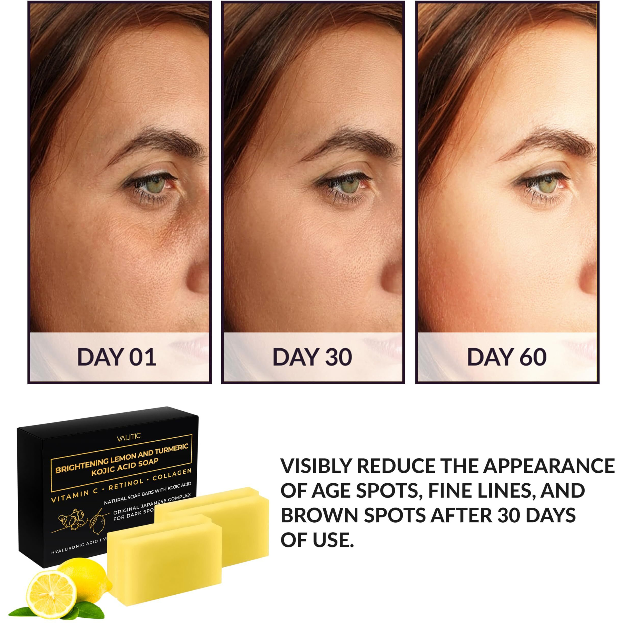 Valitic Brightening Lemon & Turmeric Kojic Acid Soap With Vitamin C  Retinol  Collagen - Original Japanese Complex Infused With Hyaluronic Acid  Vitamin E  Shea Butter  Castile Olive Oil (4 Pack)