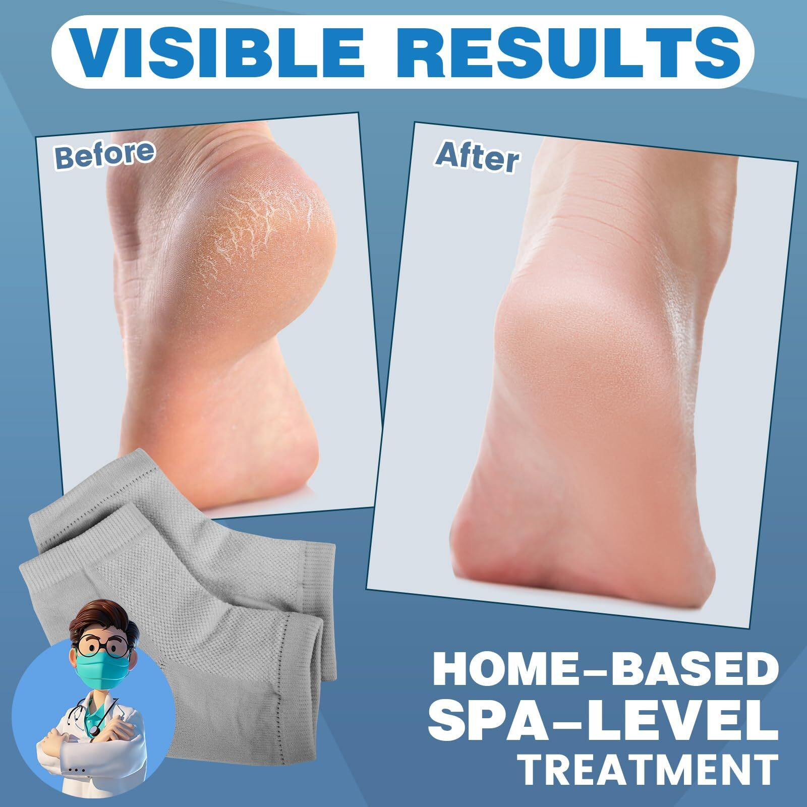 Teawoo 6 Pairs Moisturizing Heel Socks For Cracked Heel Treatment  Foot Care Toeless Socks To Soften And Hydrate Dry Cracked Feet Heels  Cracked Heel Repair Socks  Gel Socks For Dry Cracked Feet