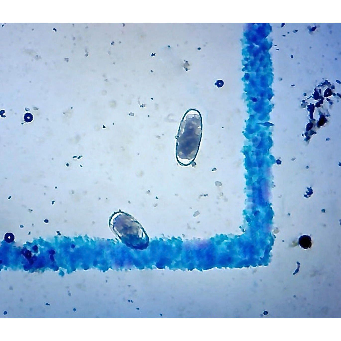 Mcmaster Method Microscope Slide  Fec (Fecal Egg Count) Or Worm Count  Double Chamber Slide For Parasite Testing And Management  Count Parasite Eggs In Horses  Sheep  Goats And Cattle.