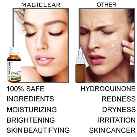 Luxury Swiss Dark Spot Remover For Face Body Serum Age Sun Brown Spot Freckles Corrector Melasma Treatment Anti Aging Skin Vitamin C + Niacinamide Organic Magiclear