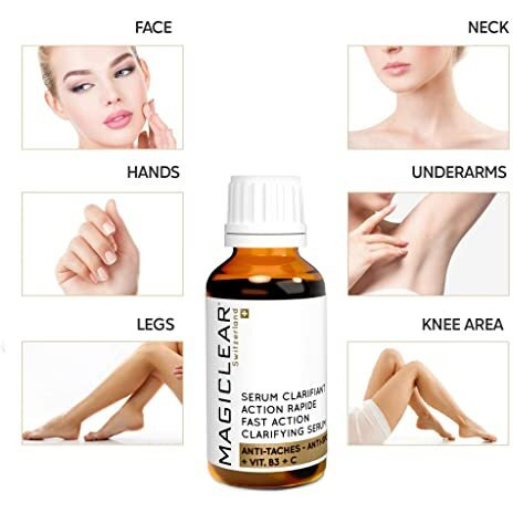 Luxury Swiss Dark Spot Remover For Face Body Serum Age Sun Brown Spot Freckles Corrector Melasma Treatment Anti Aging Skin Vitamin C + Niacinamide Organic Magiclear