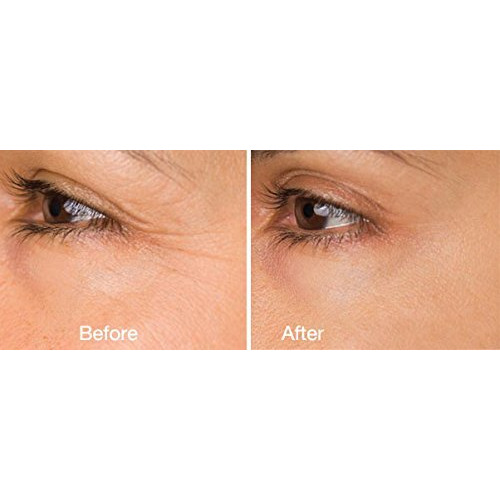 Dna Code Neuropeptides Argireline Serum+Matrixyl 3000  Syn-Ake  Snap-8  Copper Peptides