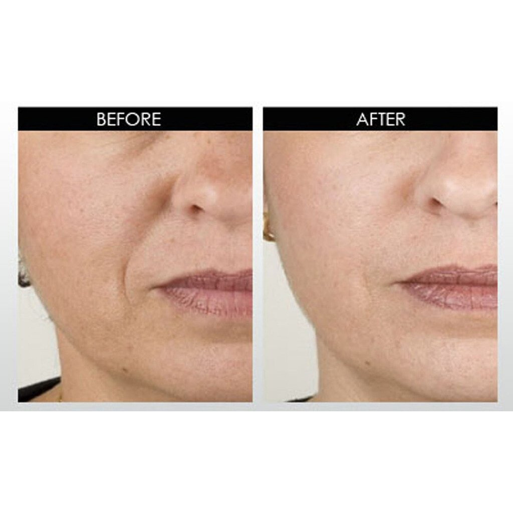 Dna Code Neuropeptides Argireline Serum+Matrixyl 3000  Syn-Ake  Snap-8  Copper Peptides