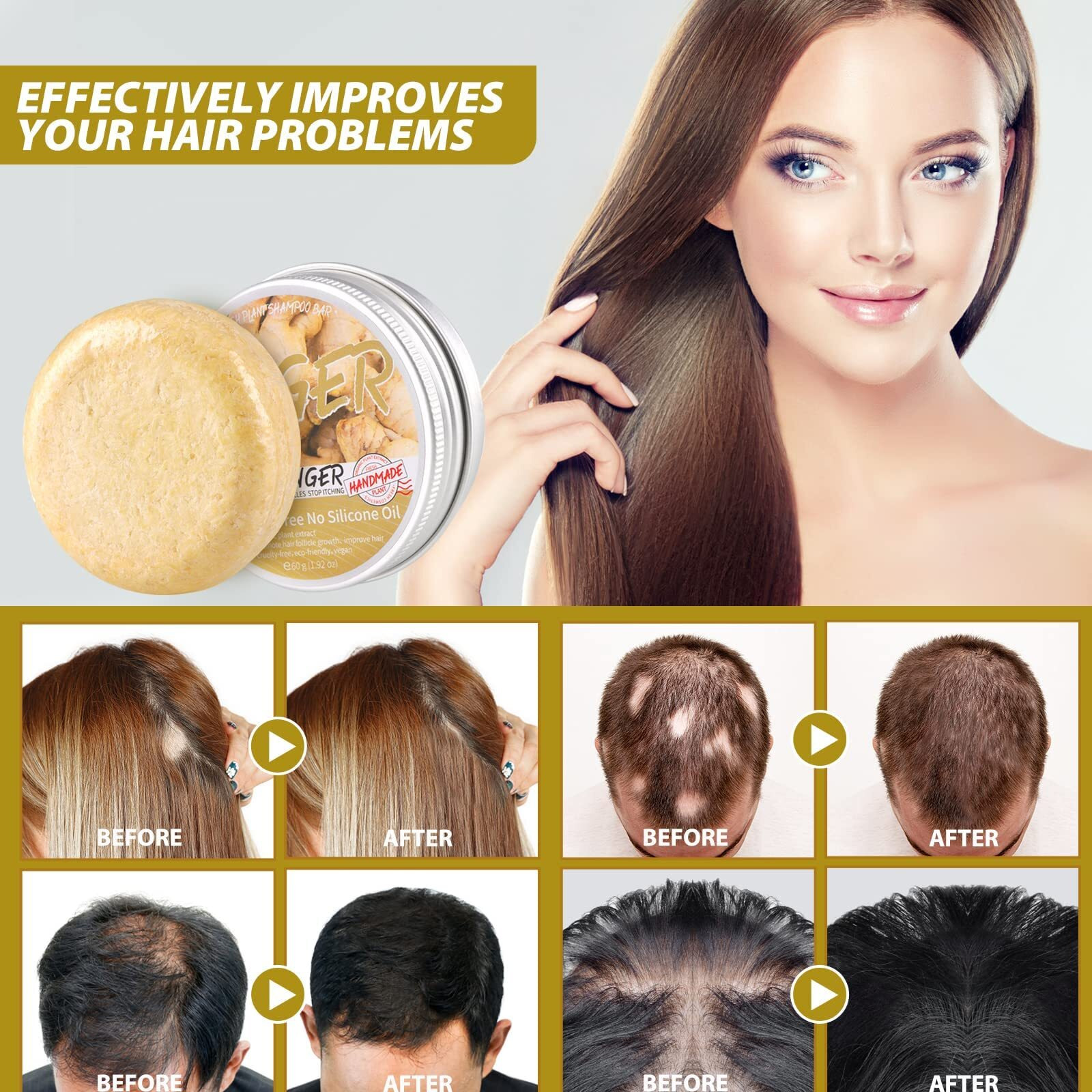 3Pcs Ginger Hair Growth Shampoo  Anti Hair Loss Natural Organic Shampoo