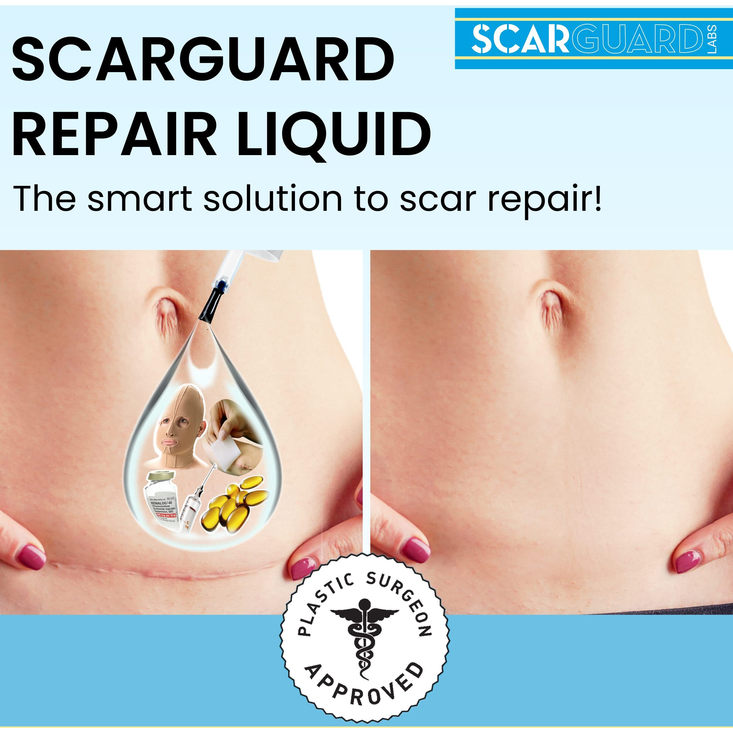 Scarguard - Invisible Brush-On Silicone Sheet With Vitamin E - Scar Removal For Keloids  Burn Scars  Surgery Scars  Stitches  Cuts - No Ugly Scar Sheets  Cream Or Messy Scar Gel Needed