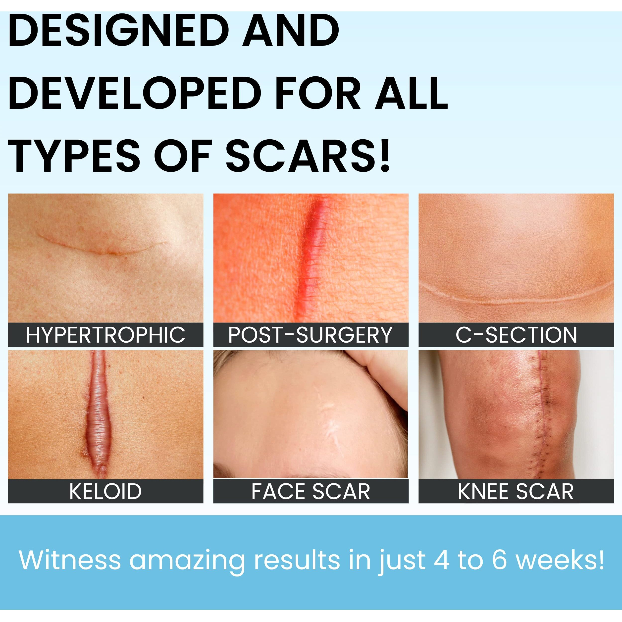 Scarguard - Invisible Brush-On Silicone Sheet With Vitamin E - Scar Removal For Keloids  Burn Scars  Surgery Scars  Stitches  Cuts - No Ugly Scar Sheets  Cream Or Messy Scar Gel Needed
