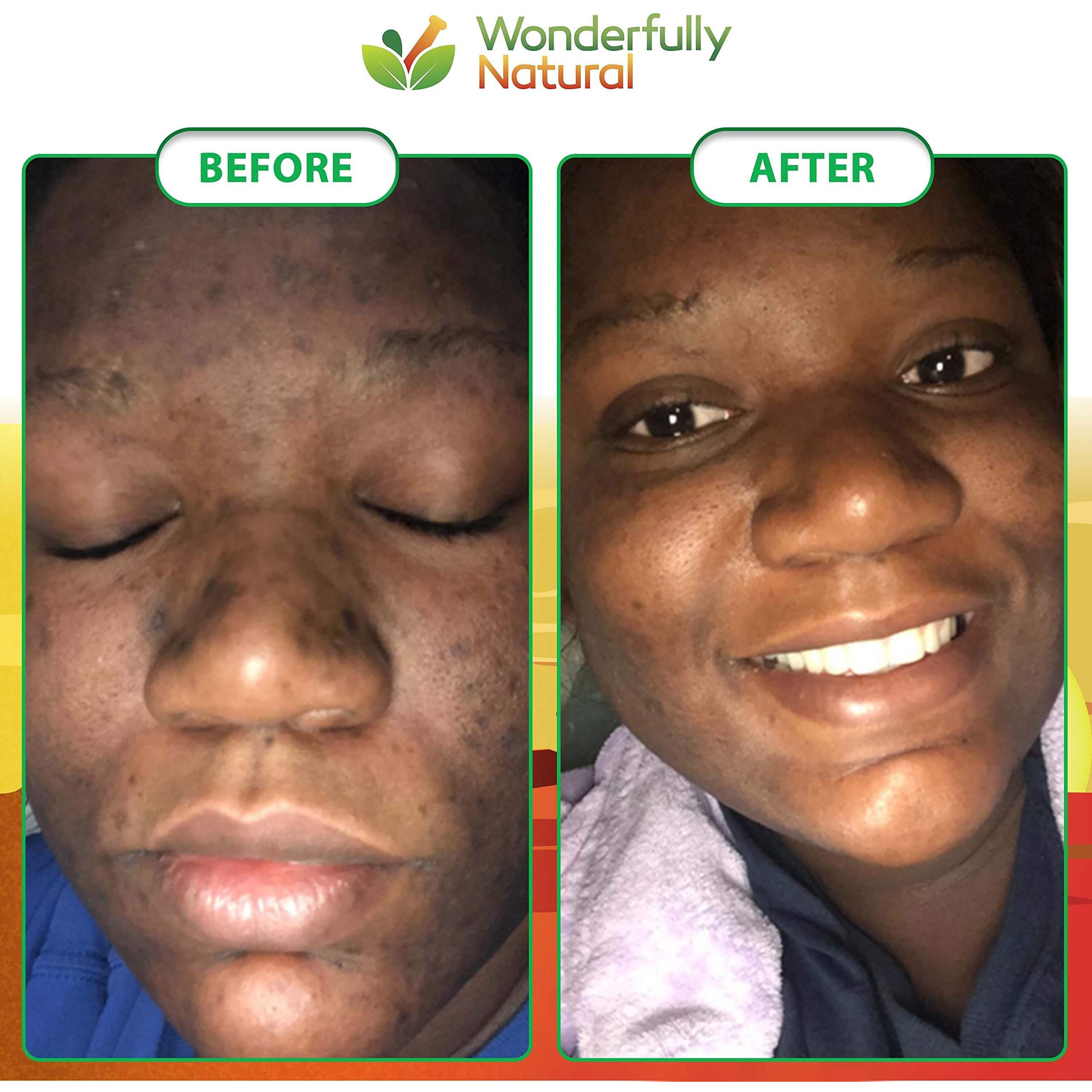 Organic African Black Soap - For Acne & Dark Spots | Natural Vegan And Cruelty Free - Satisfaction Guarantee 1Lb Bar | 90 Day Supply