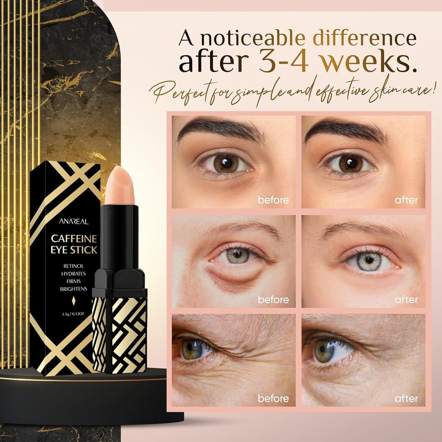 Caffeine Under Eye Balm Hydrating Eye Brightener Stick Cream For Dark Circles & Puffiness  Anti-Wrinkle Korean Skincare Treatment With Retinol  Instant Cooling Glow For Eyes  Face & Bags