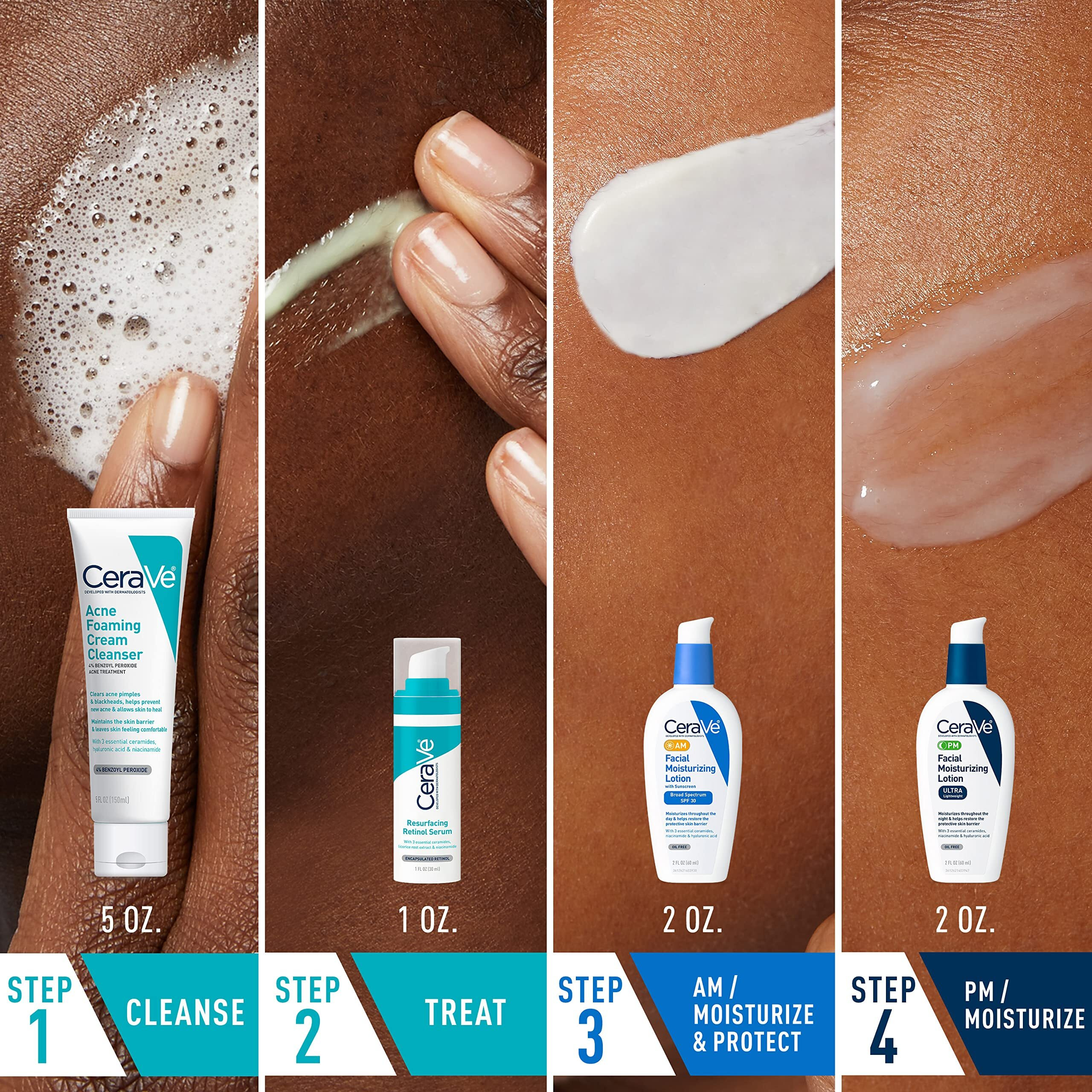 Cerave Acne Skin Care Set  5Oz Acne Foaming Cream Cleanser + 1Oz Resurfacing Retinol Serum + 2Oz Am Facial Moisturizing Lotion With Spf 30 + 2Oz Pm Facial Moisturizing Lotion  Skin Care Gift Sets
