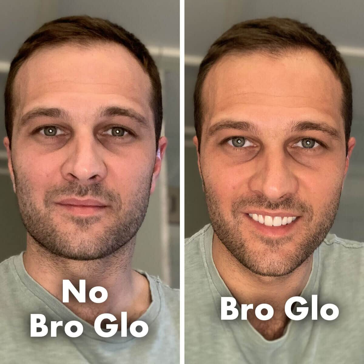 Bro Glo Self Tanner For The Boys - Quick Application Foam Mousse - Easy Sunless Tan For Your Face - Oil Free Water Based For Faster Skin Drying - Natural Sun Kissed Bronze Color Perfect For Men - Beach And Pool Not Required 3.4 Fl Oz