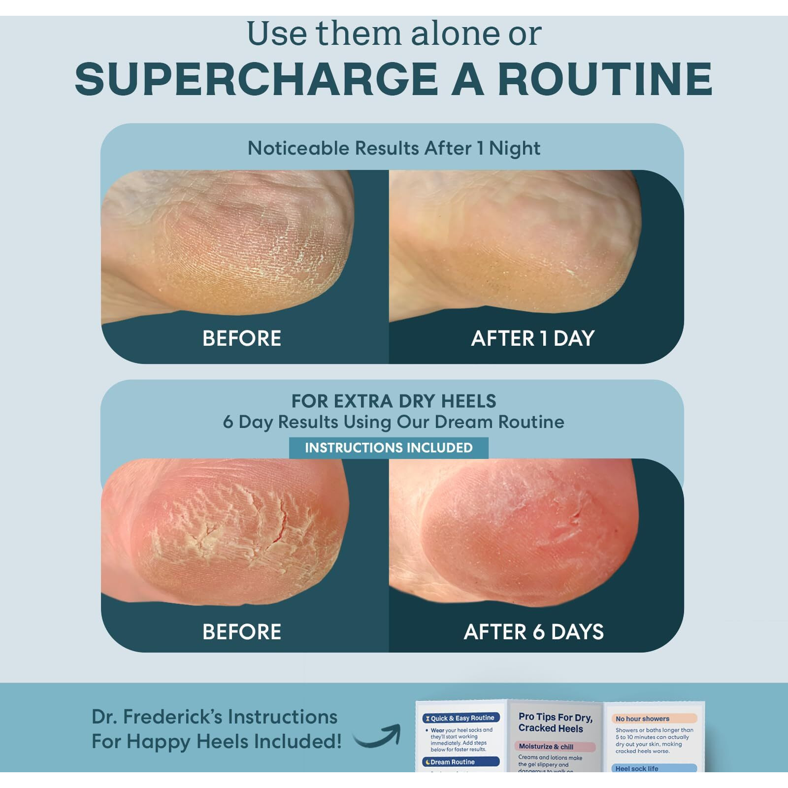 Dr. Frederick's Original Moisturizing Fuzzy Heel Socks - 2 Pairs - Cozy Gel-Lined Sleep Socks For Women & Men - Soothing Dry  Cracked Feet - Cracked Heel Repair - Heal Dry Heels - Teal Tranquility