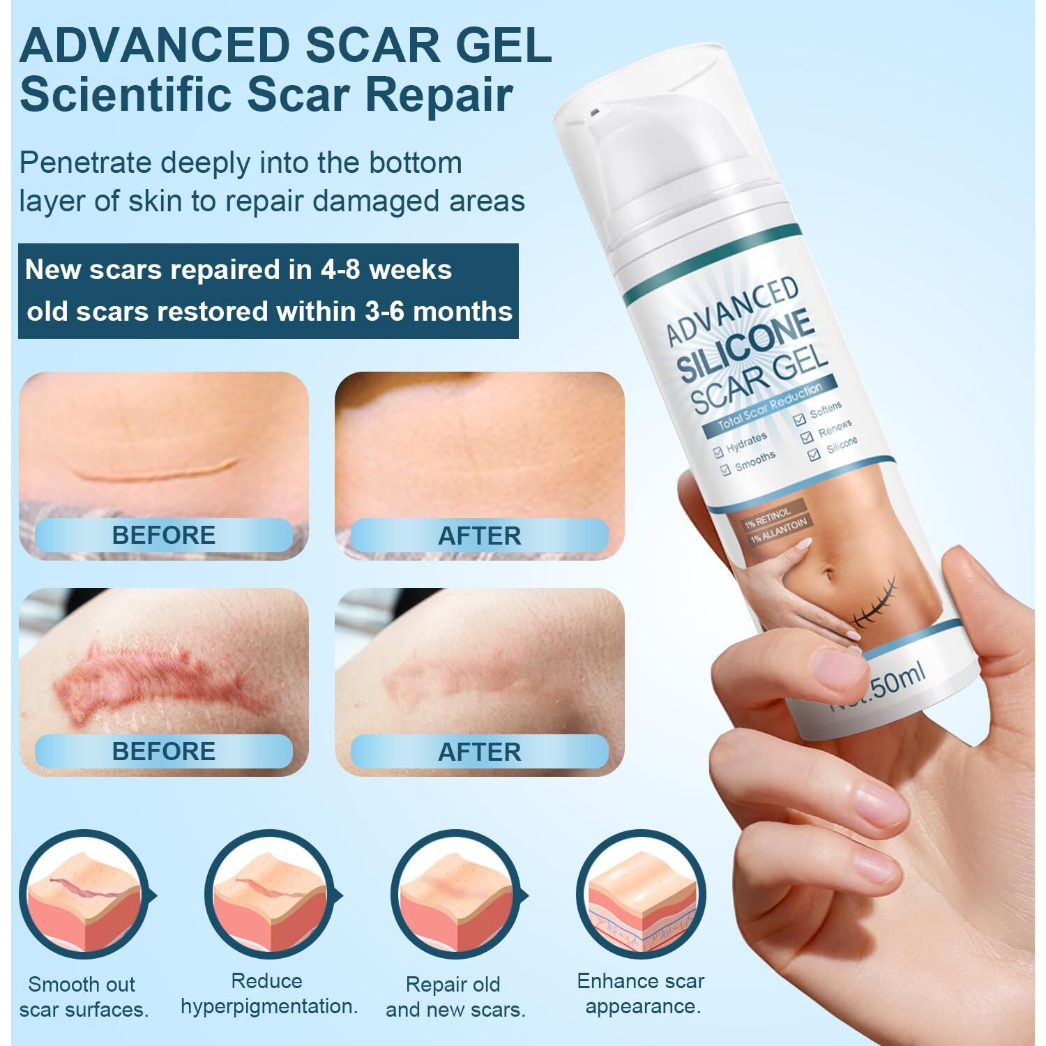 Advanced Scar Cream  Silicone Scar Gel  Treats Old And New Scars  Reduces The Appearance Of Scars From  Body  Face  Stretch Marks  Surgical Scar  Keloids  Acne  Burns And More  1.7 Oz