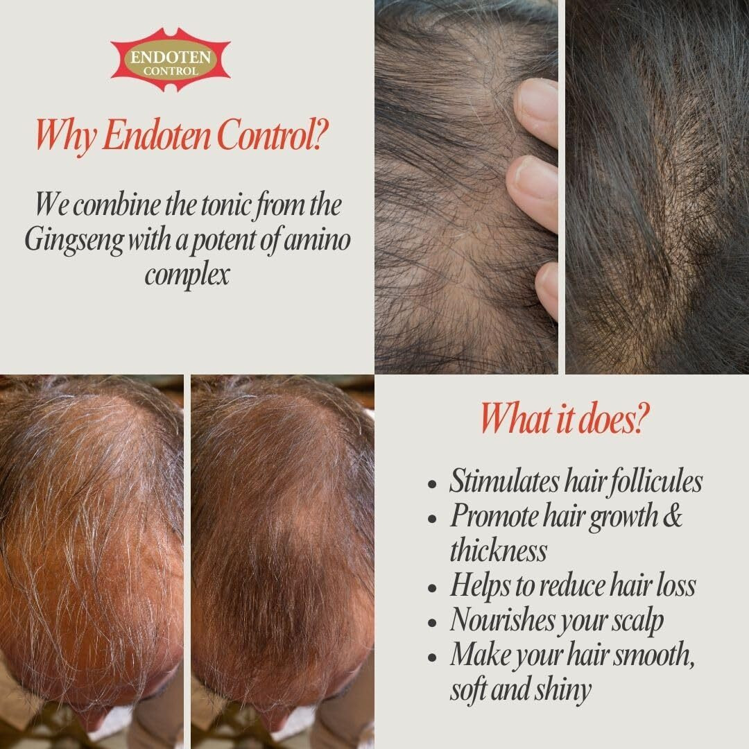 Endoten - Control Lotion 200 Ml