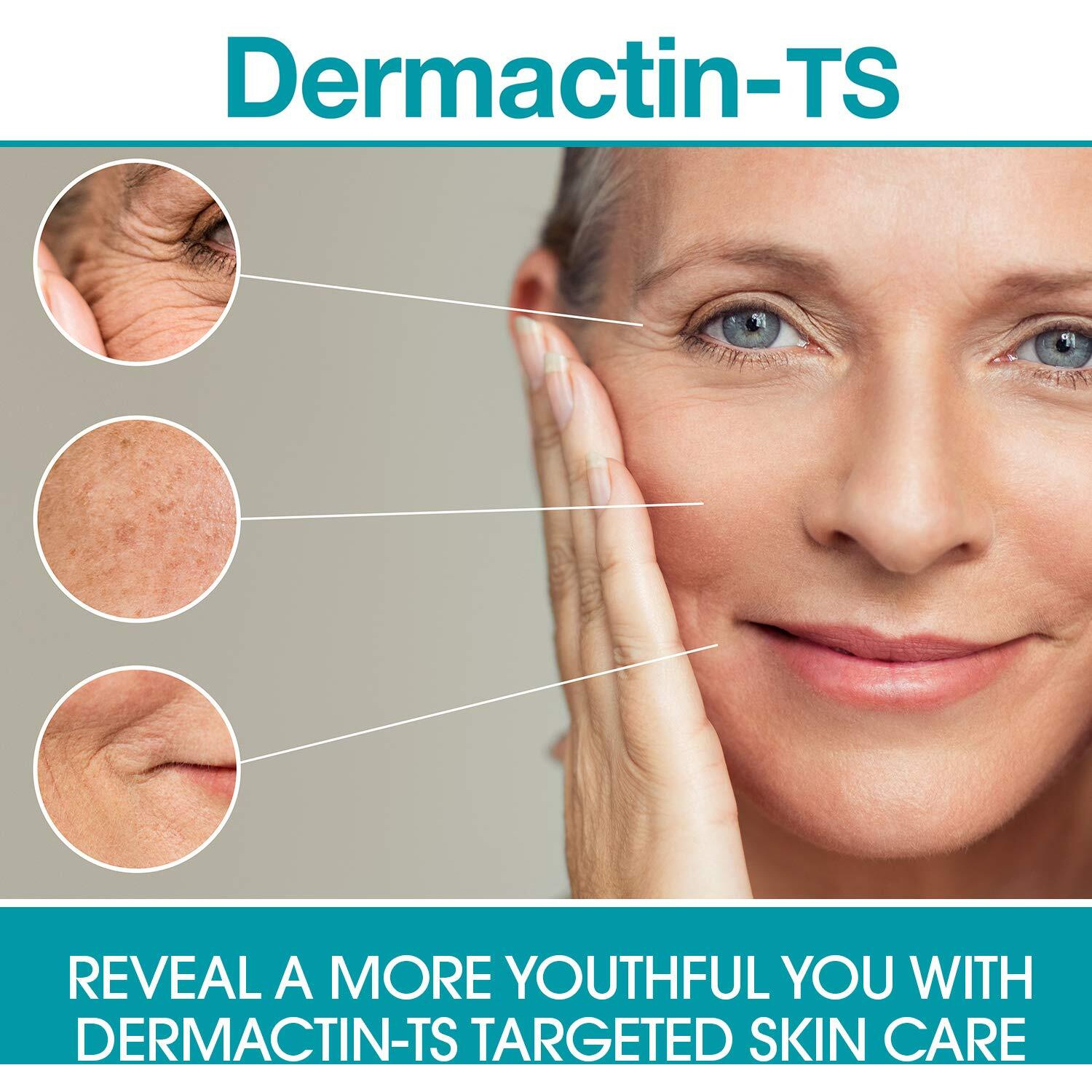 Dermactin-Ts Stretch Mark Complex Concentrated Formula 177Ml By Dermactin By Dermactin