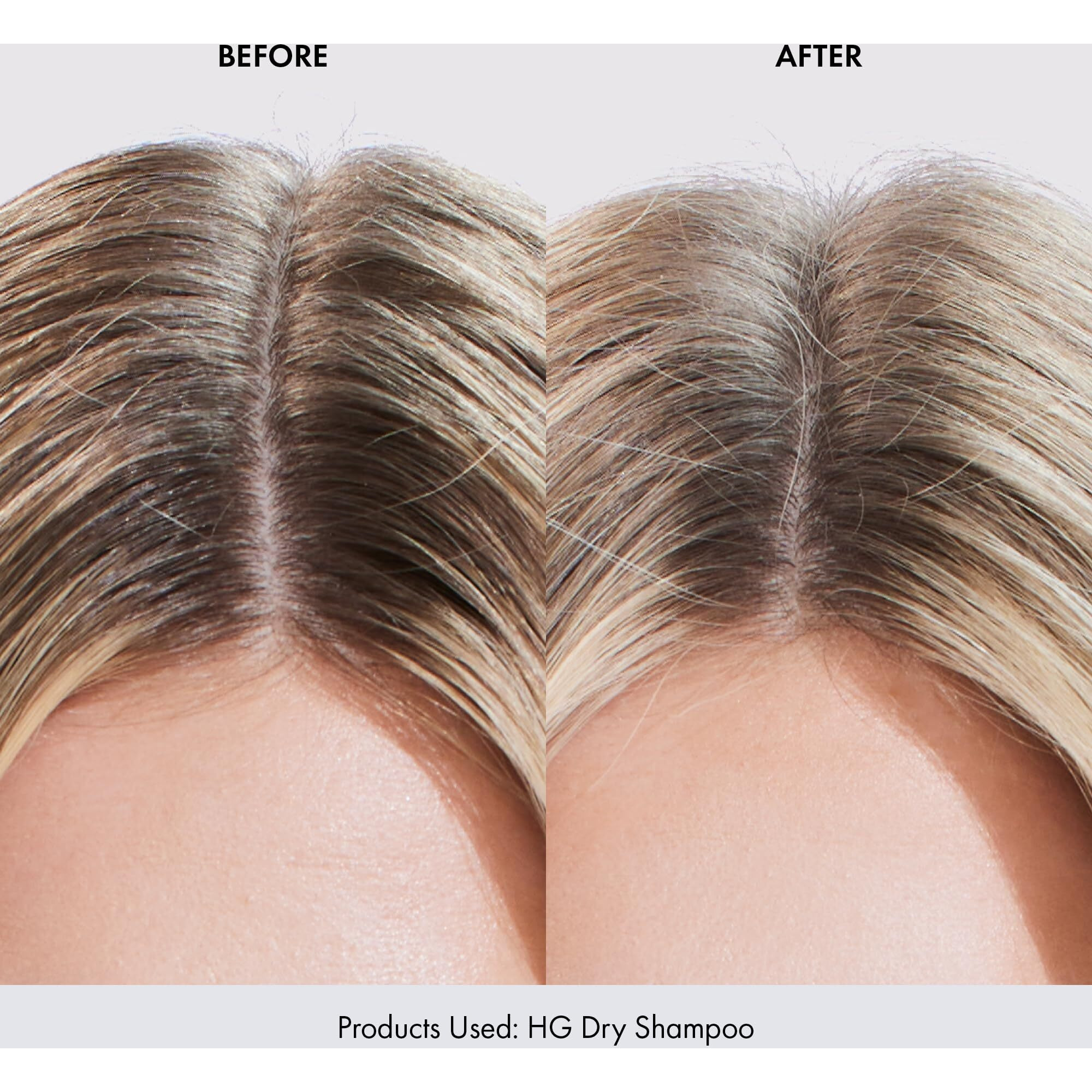 Bondiboost Hg Dry Shampoo Spray [3.95 Oz]  Instantly Refresh + Protects & Strengthens Hair  Infused With Rosemary Oil  Works For All Hair Types Including Color