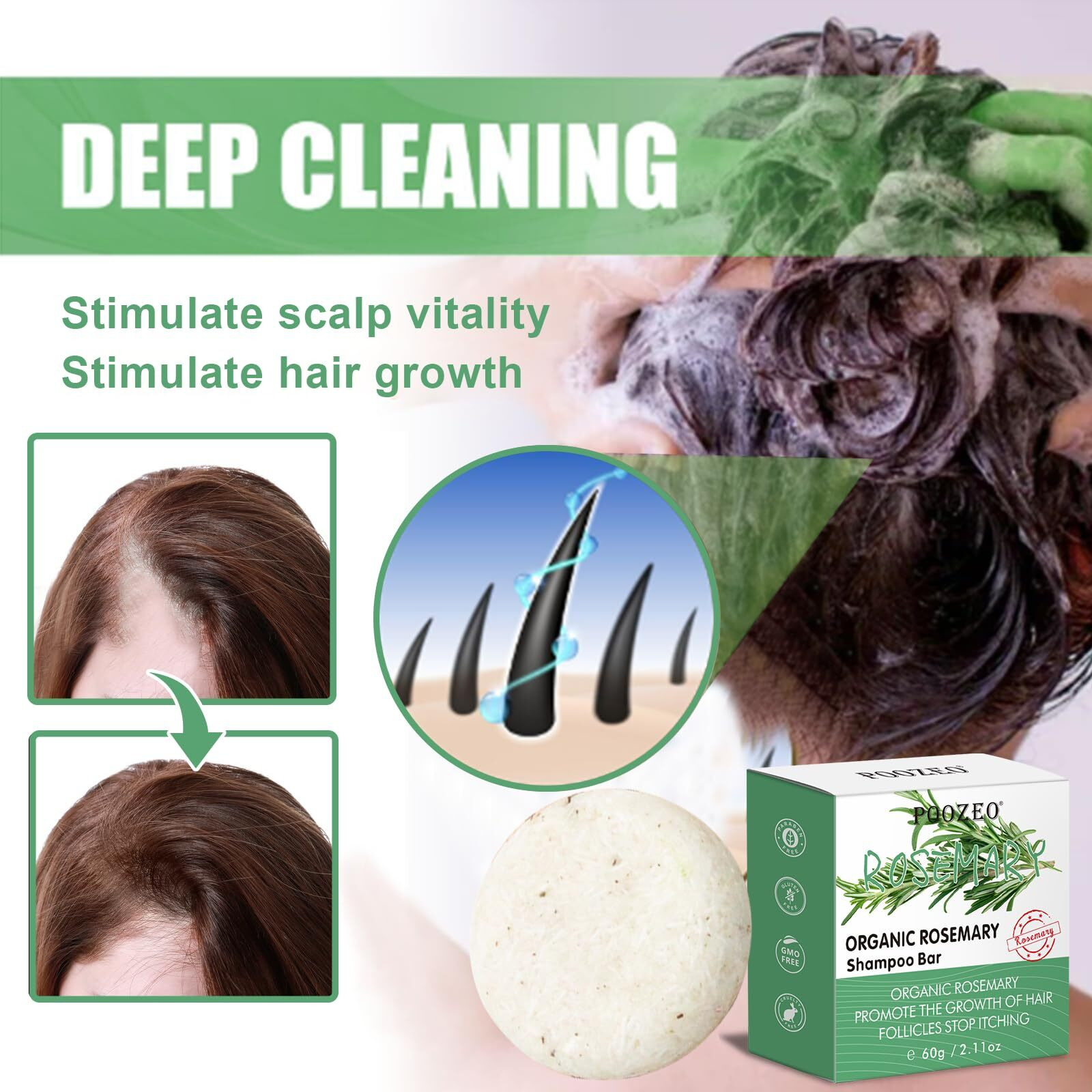 Dbeautym 2 Pack Rosemary Hair Shampoo Bar Deep Cleansing For Scalp Hair Loss Shampoo Soap Organic Hair Oil Control Solid Shampoo For Hair Growth  Refreshing And Hydrating Soap For Mothers Day Gifts