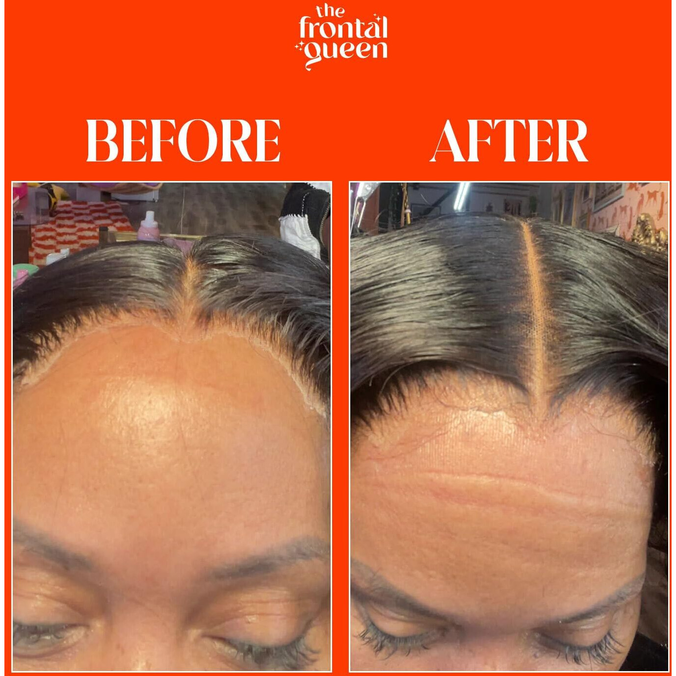 The Frontal Queen Lace Melting Spray  Ashy Lace Melting Spray For Lace Wigs  Lace Bond Spray  Extra Hold Lace Melting Spray Adhesive Wig  No Residue  Long Lasting Safe Formula - 4.2 Oz