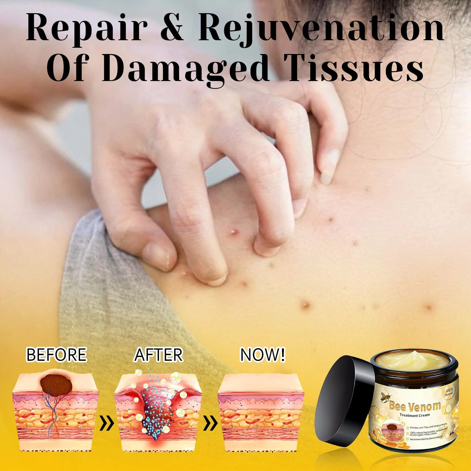 Bee Venom Cream  2025 New Professional Bee Venom Treatment Cream  Natural Bee Venom Repair Cream  Bee Venom Treatment Gel  Suitable For All Skin Types (2 Bottles)