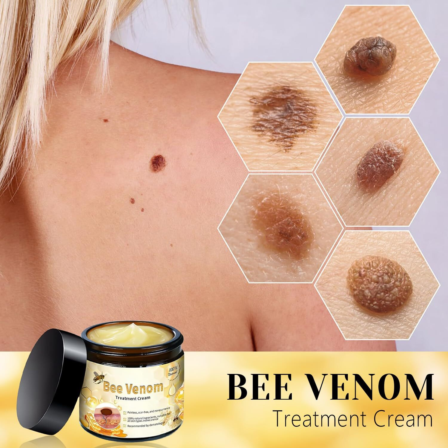Bee Venom Cream  2025 New Professional Bee Venom Treatment Cream  Natural Bee Venom Repair Cream  Bee Venom Treatment Gel  Suitable For All Skin Types (2 Bottles)