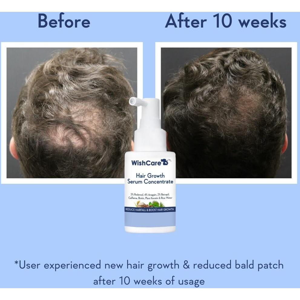 Wishcare Hair Growth Serum Concentrate - Rosemary  3% Redensyl  4% Anagain  2% Baicapil  Caffeine  Biotin  Plant Keratin & Rice Water