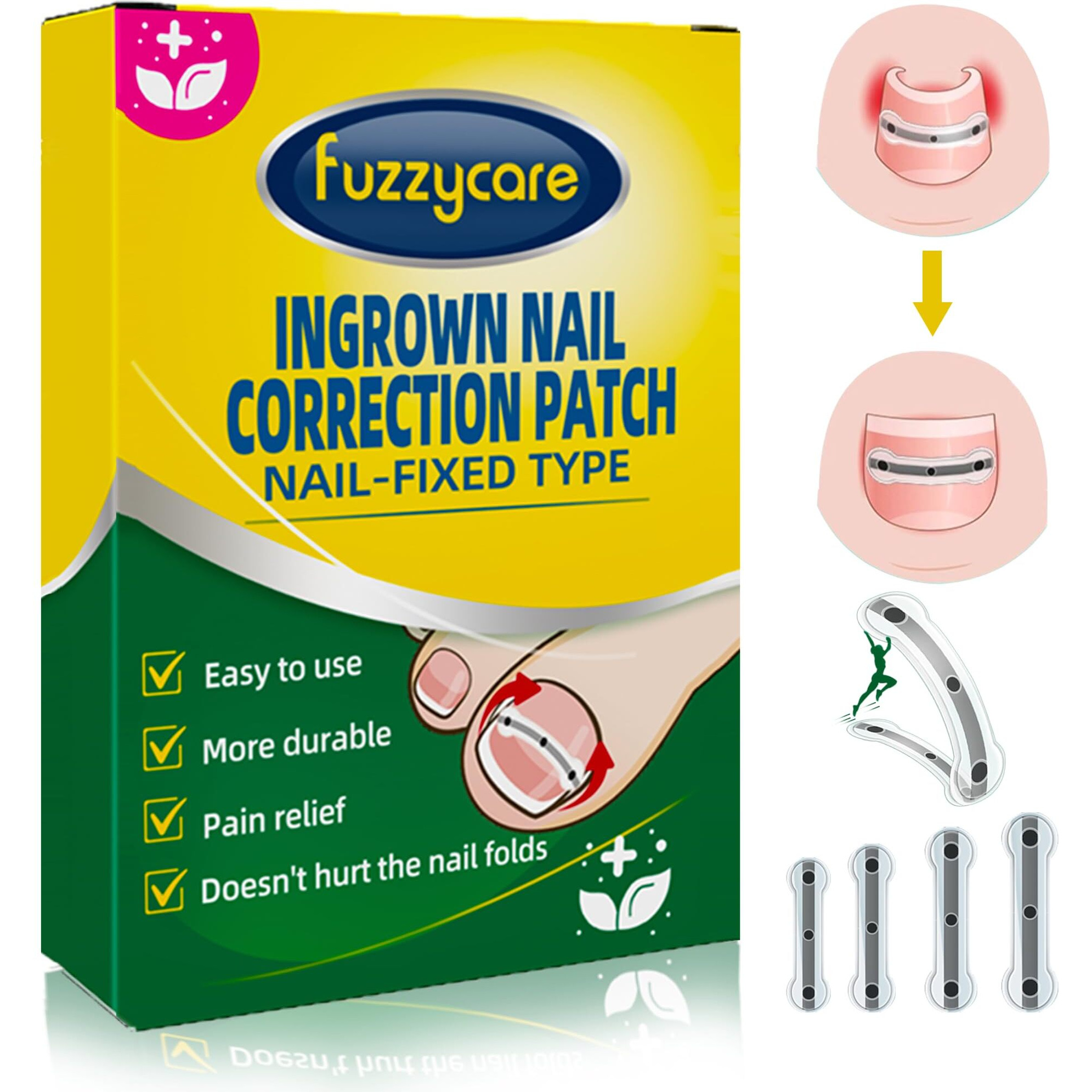 Titanium Alloy Ingrown Toenail Treatment & Removal Kit For Quick Relief  Ingrown Toenail Removal Kit  Professional Ingrown Toenail Corrector  Ingrown Toenail Tools For Quick Relief  10 Pcs